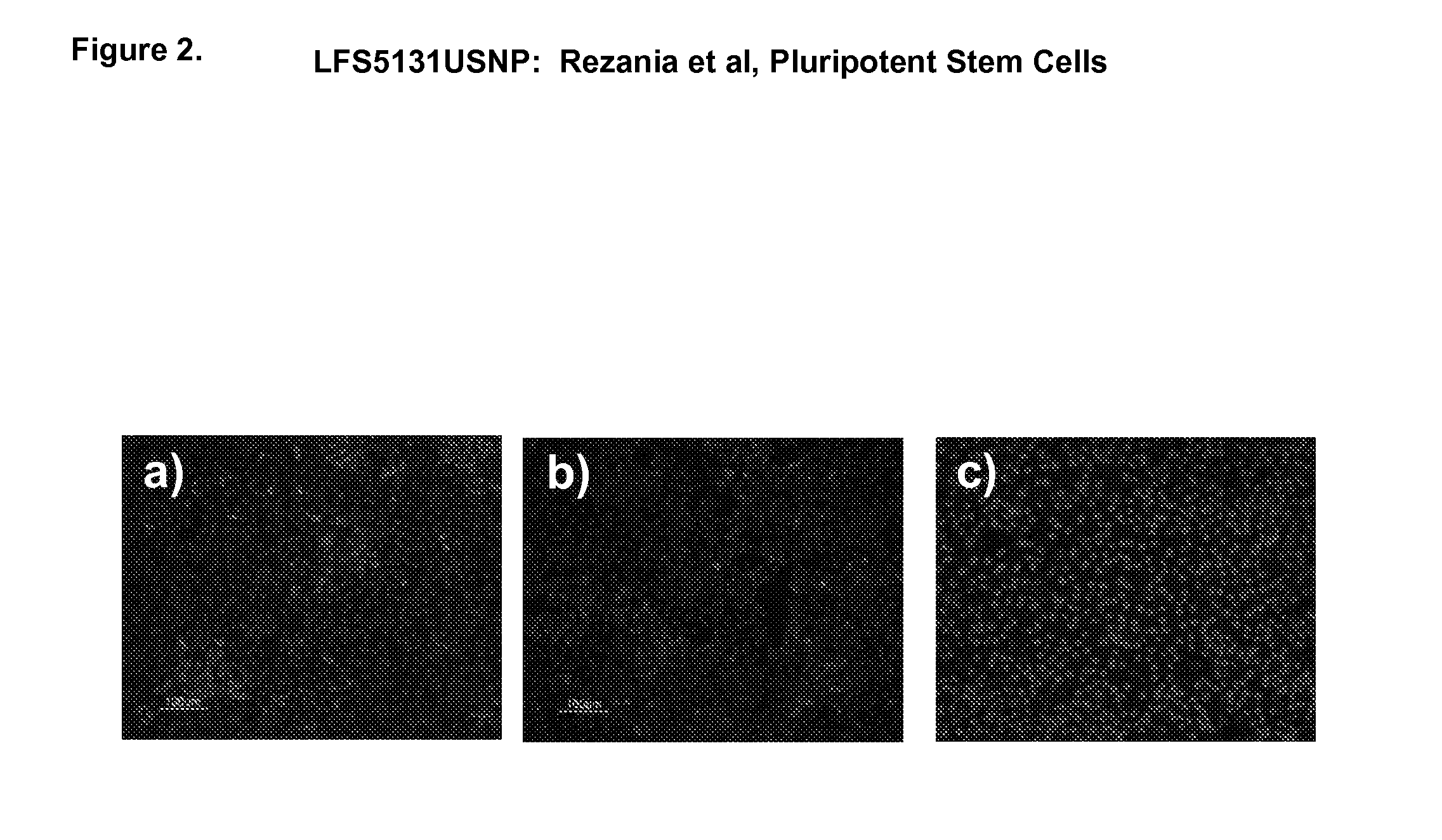 Differentiation of human embryonic stem cells