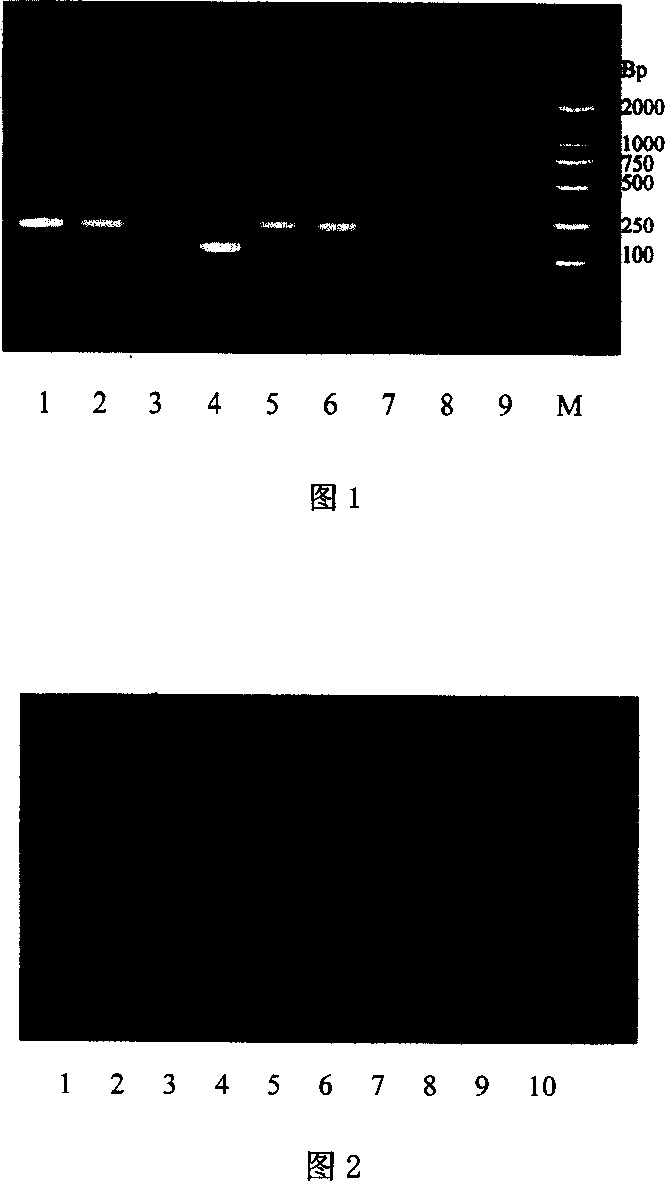 Idiosyncratic primer of repetitive sequence in gamma chromosome of oxen, and PRC method for identifying sex in early embryos of oxen