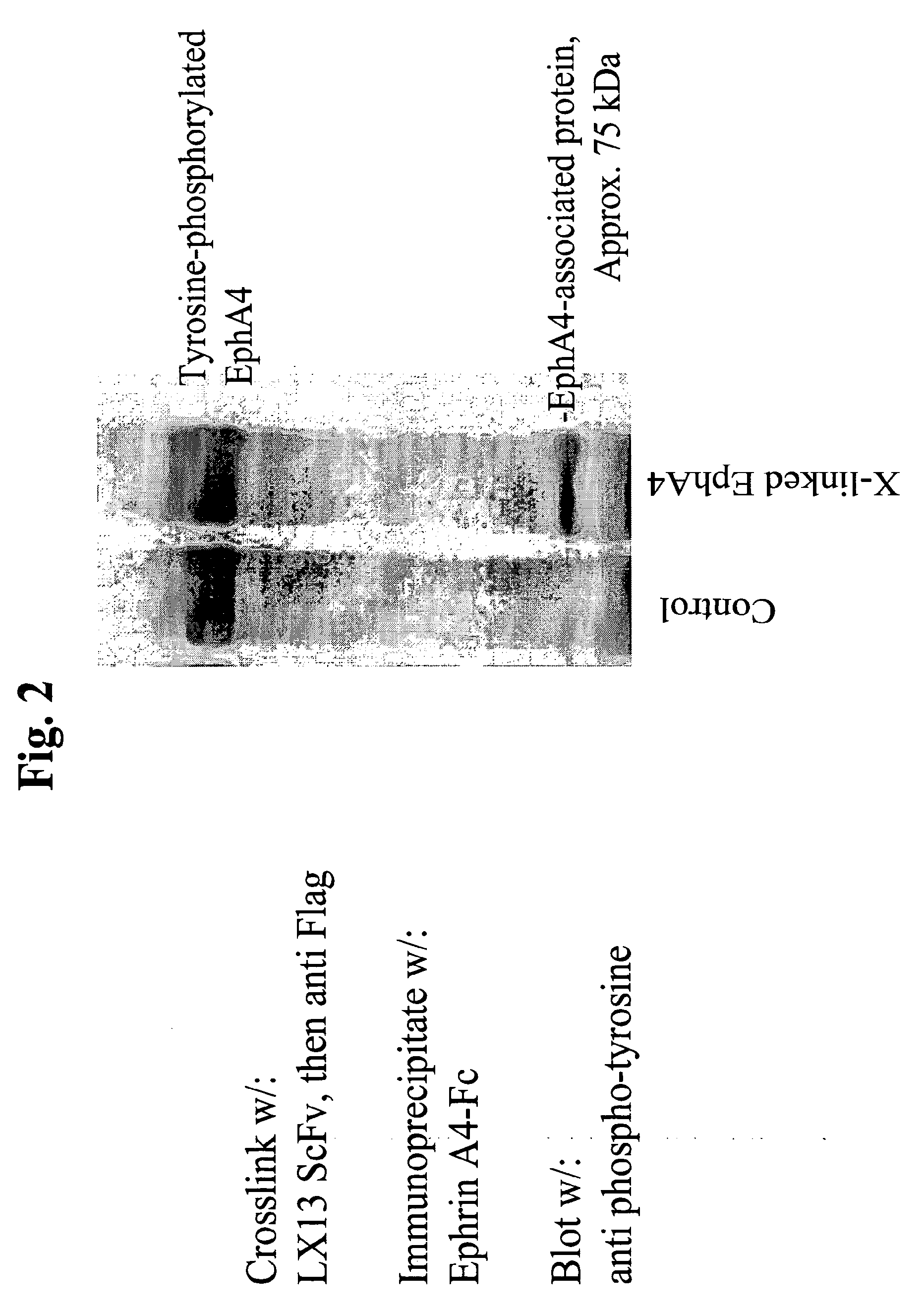 USE OF EphA4 AND MODULATOR OF EphA4 FOR DIAGNOSIS, TREATMENT AND PREVENTION OF CANCER