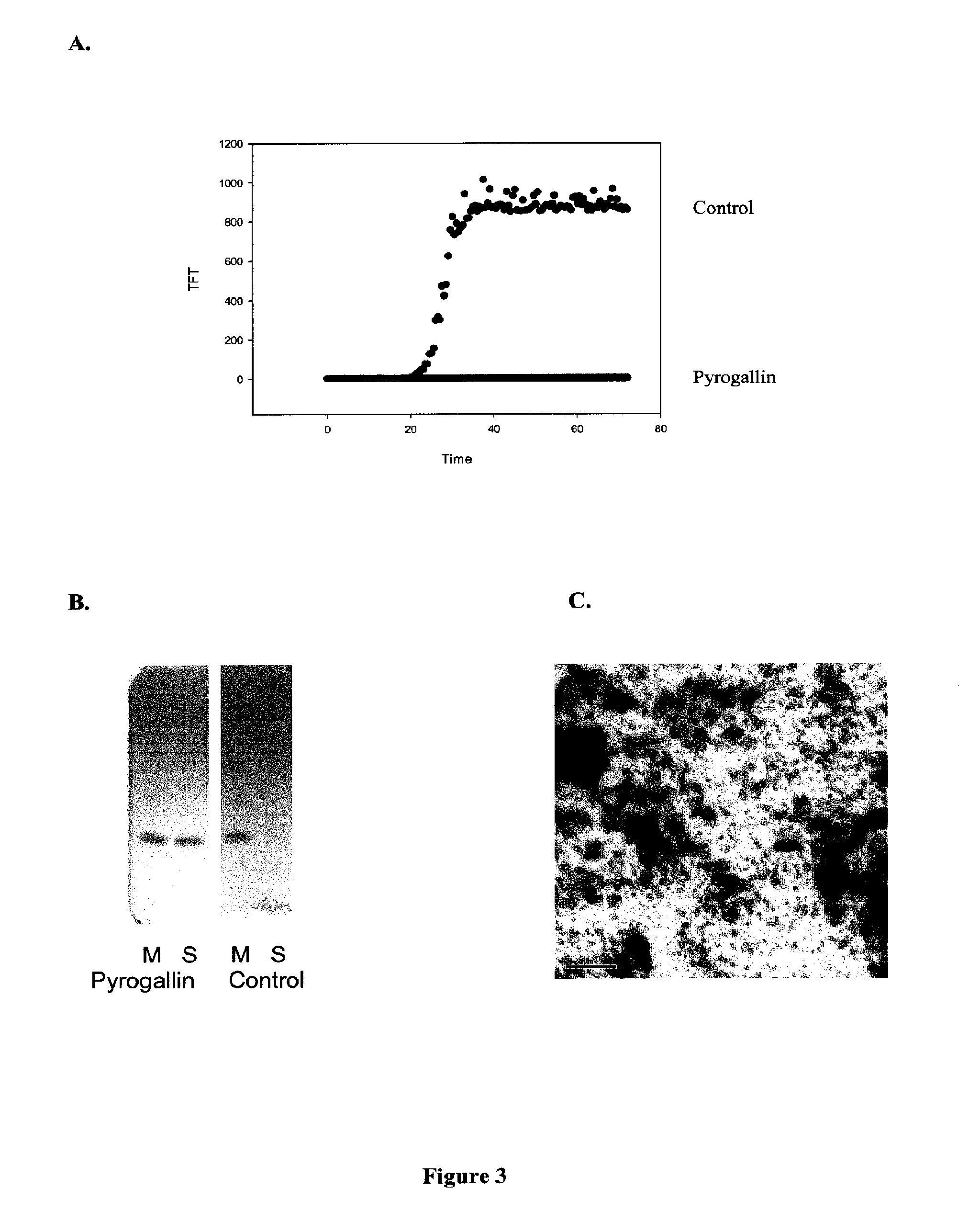 Methods and compositions for treatment of neurological disorders