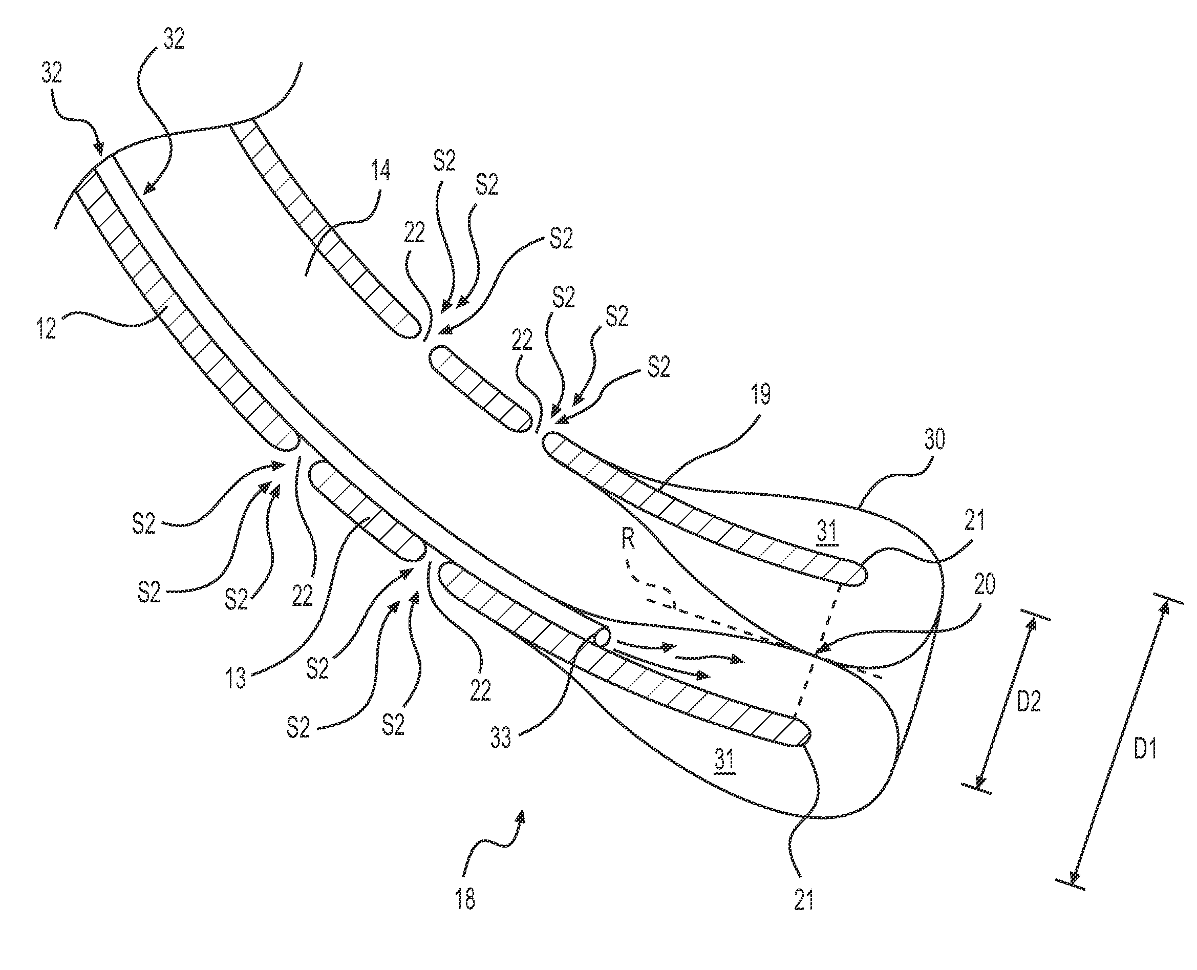 Suction catheter device and method