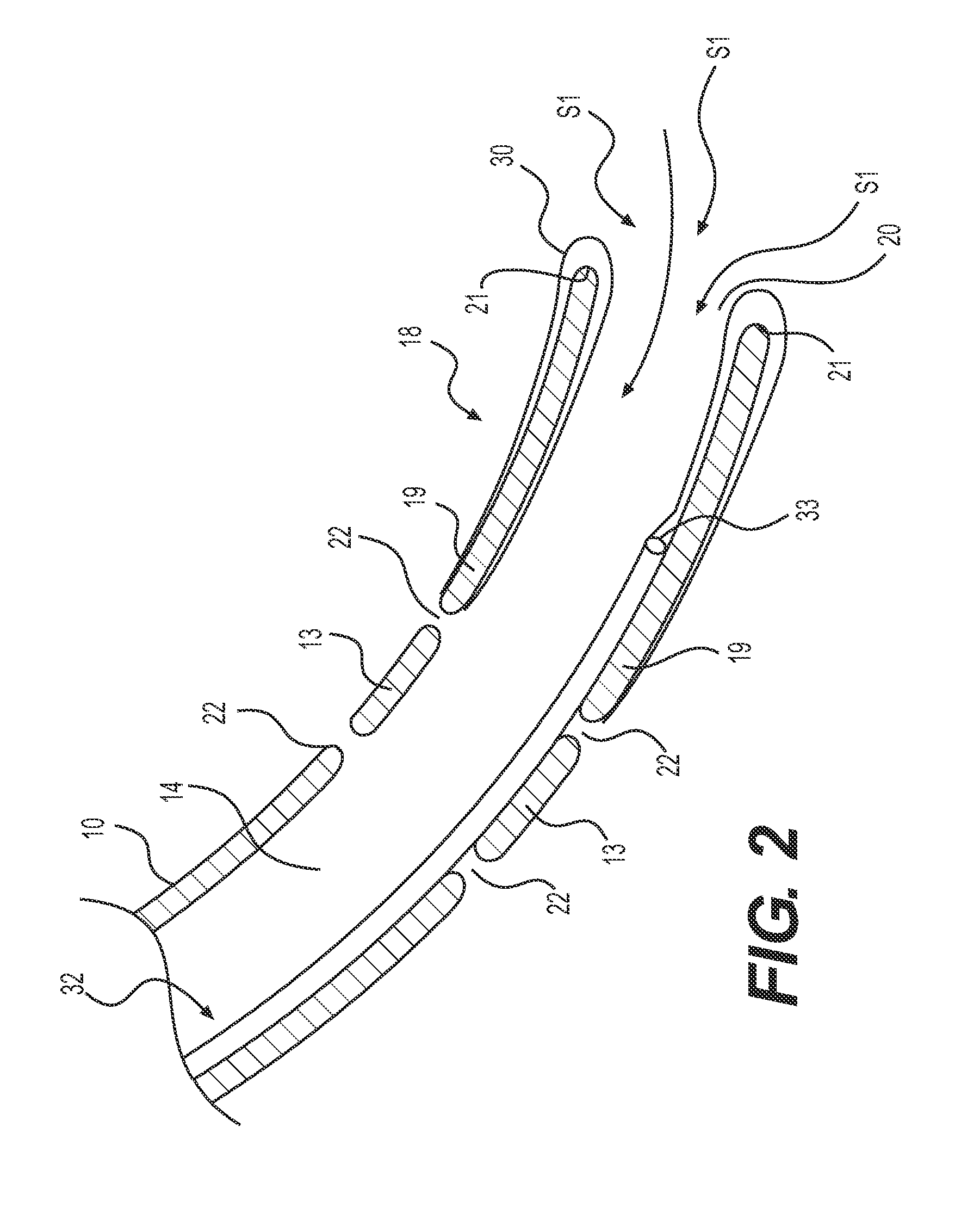 Suction catheter device and method