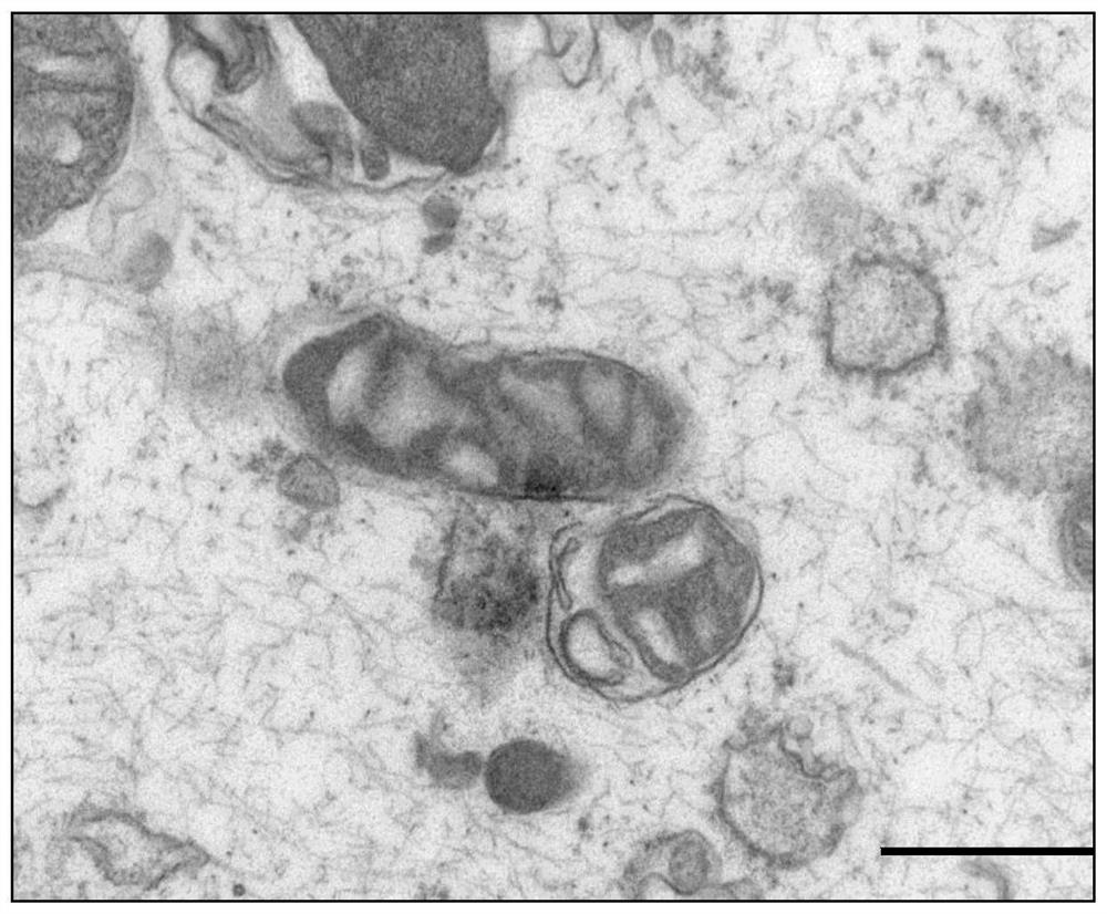 Application of mitochondrial transplantation in treatment of periodontitis