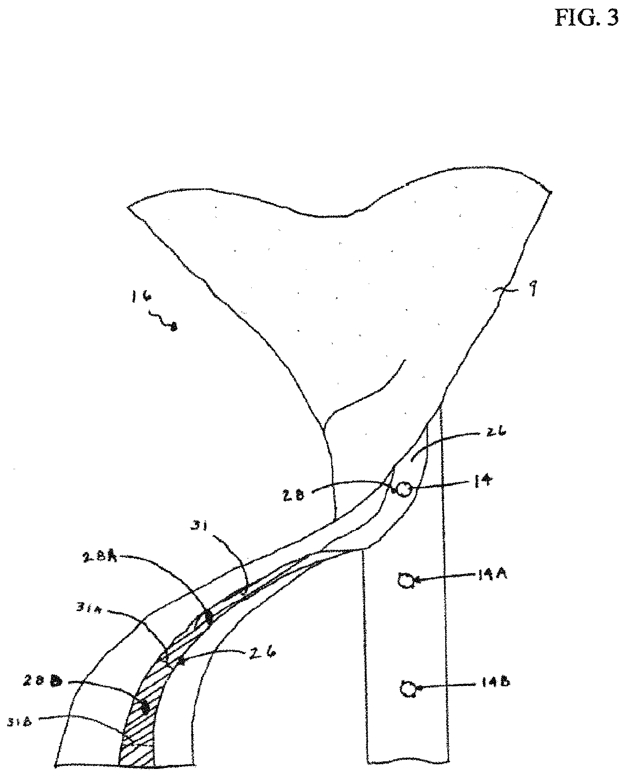 Necktie lock