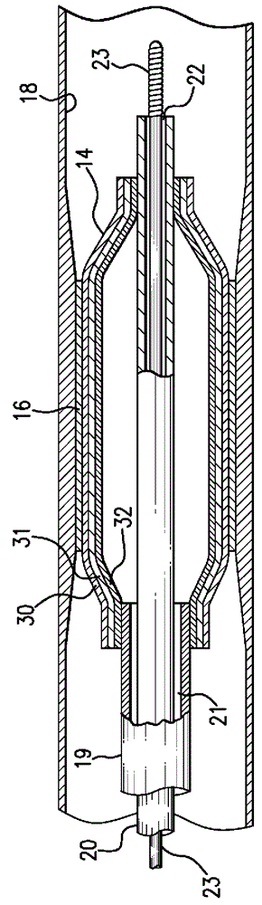 Multilayer balloon for a catheter