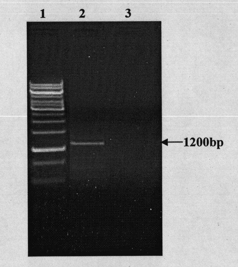 Cloning of rape Oleosin5'UTR sequence and application of Oleosin5'UTR sequence in elaioplast targeting expression