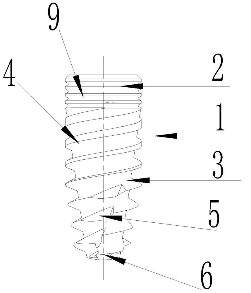 An anti-resorptive implant