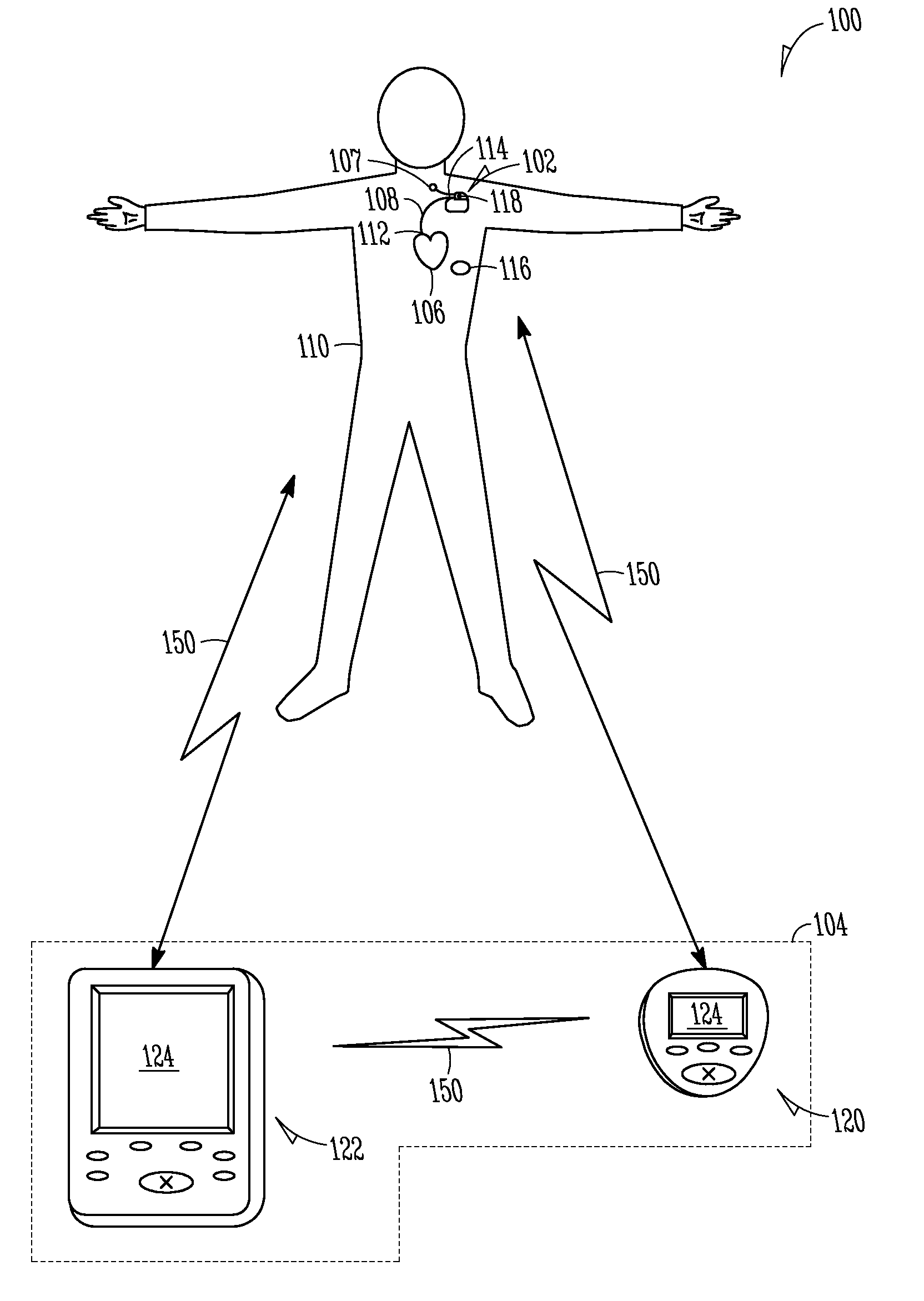 Monitoring of chronobiological rhythms for disease and drug management using one or more implantable device