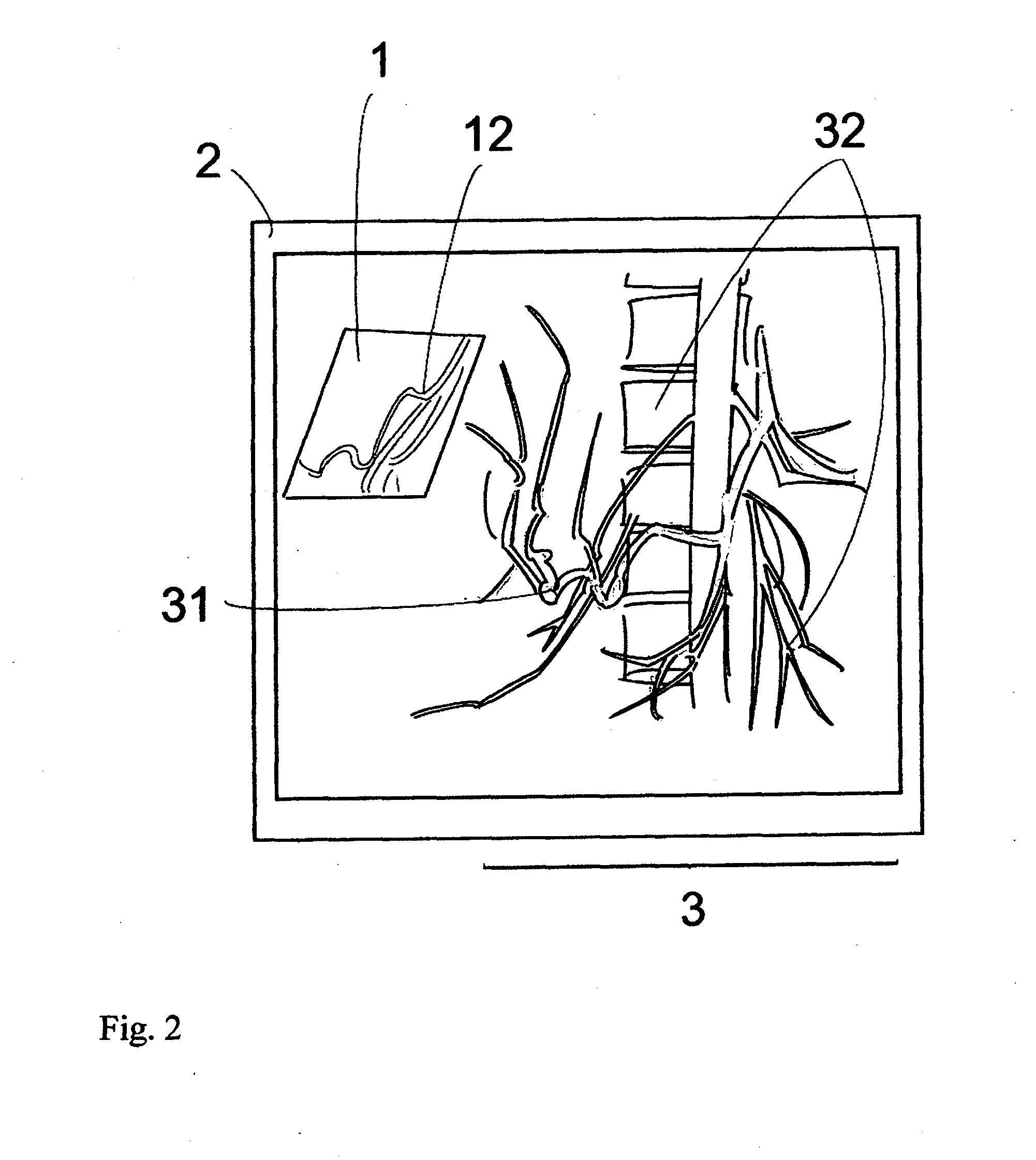 Virtual Penetrating Mirror Device for Visualizing Virtual Objects in Angiographic Applications