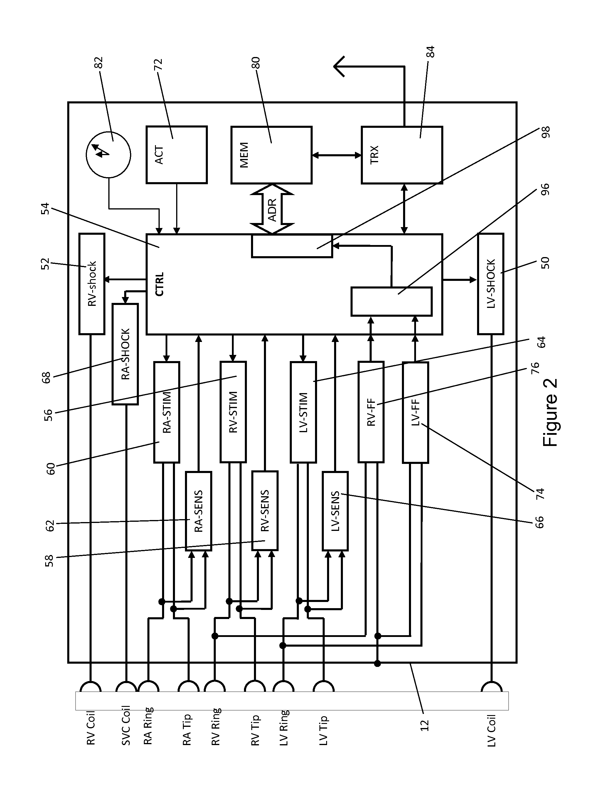 Device and method for fusion beat detection