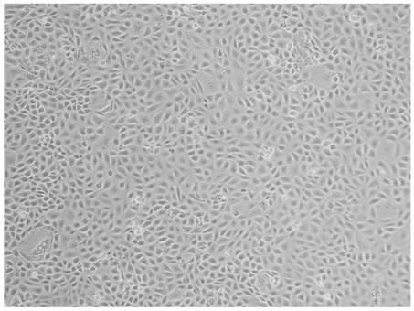 A kind of in vitro culture method of calf small intestinal epithelial cells