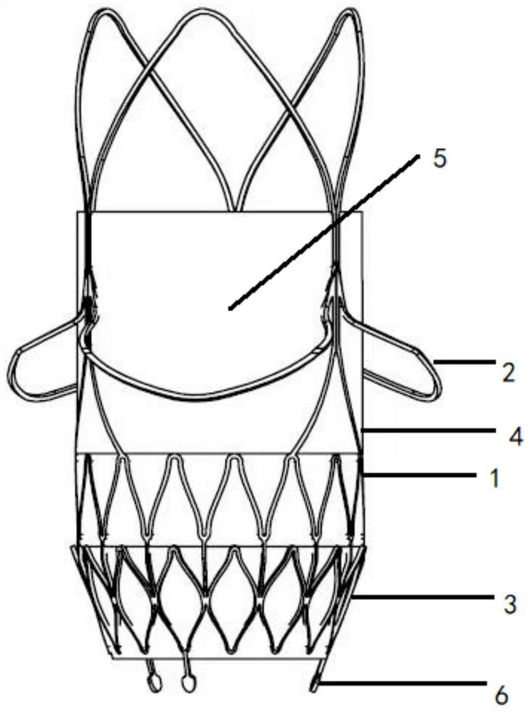 Valve stent applied to aortic valve regurgitation