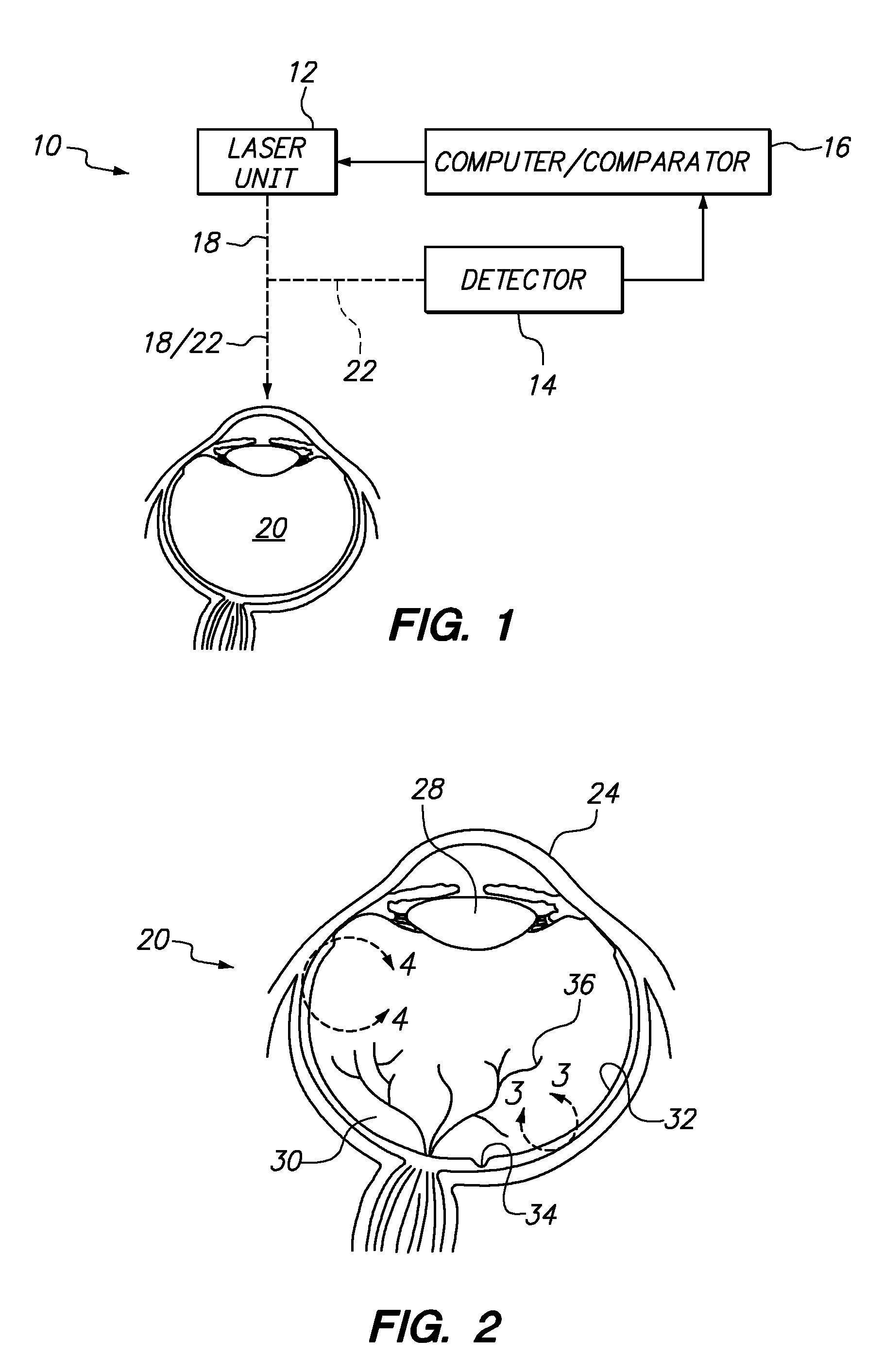 Systems and methods for treating target tissue in the vitreous cavity