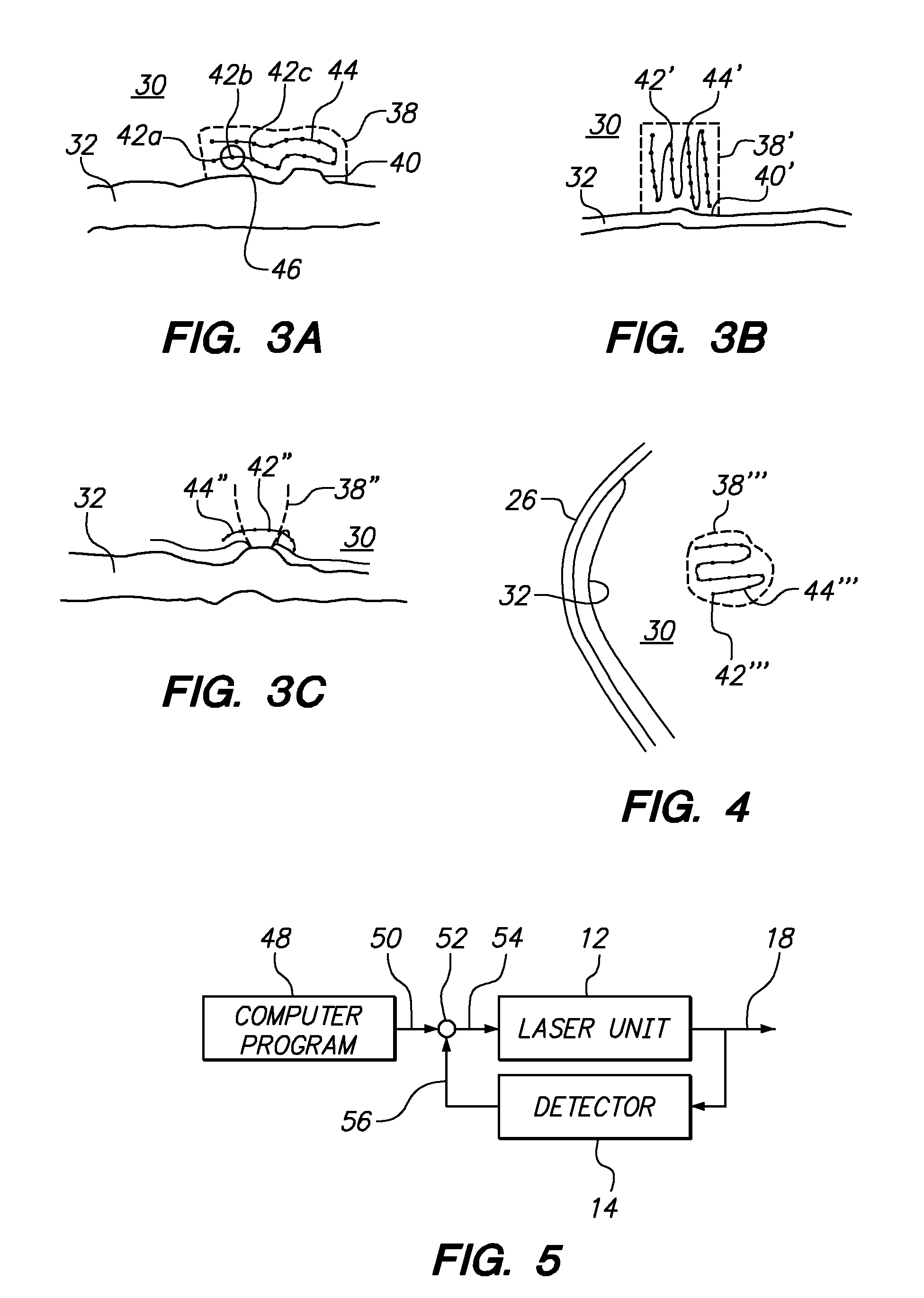 Systems and methods for treating target tissue in the vitreous cavity