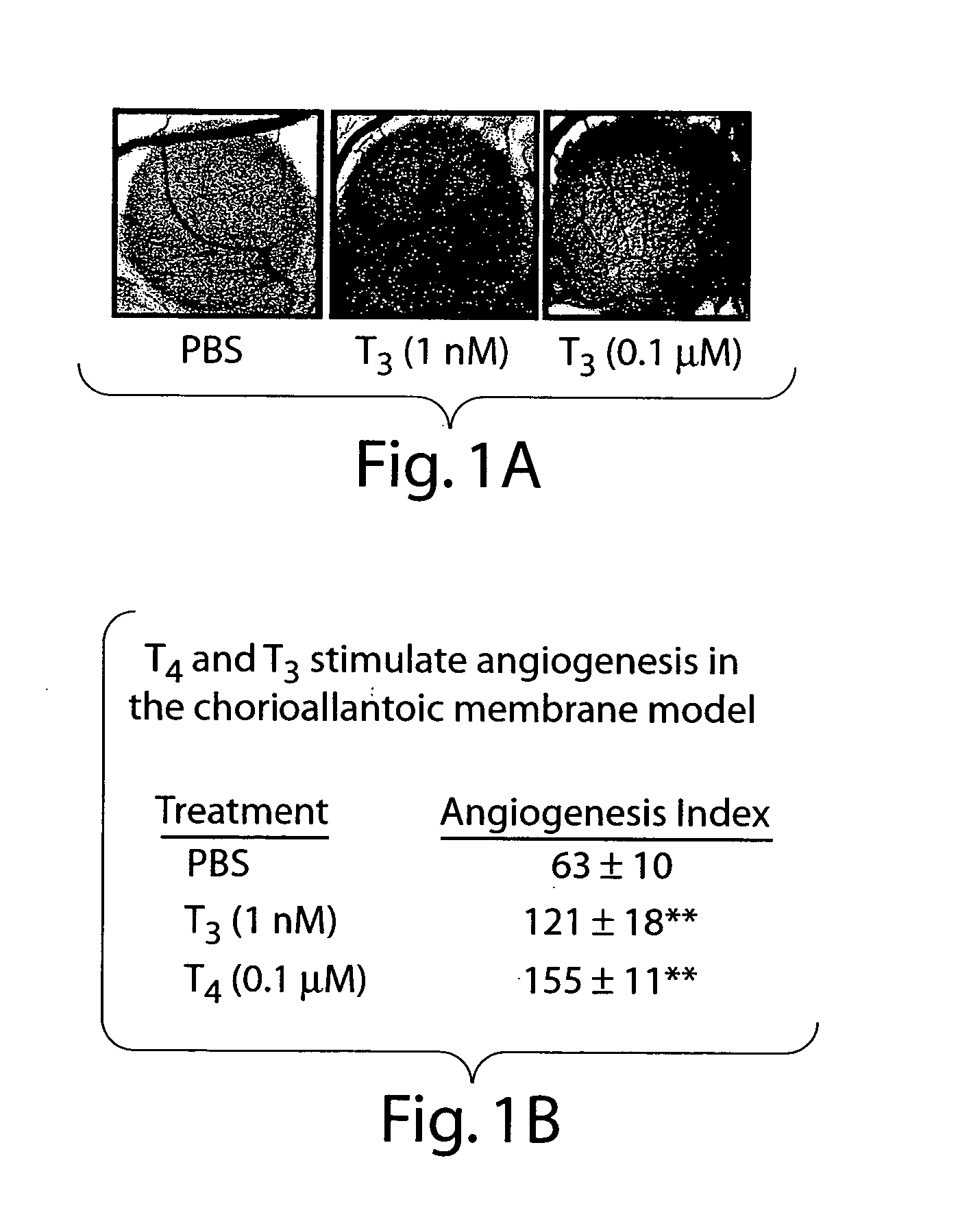 Thyroid hormone analogs and methods of use