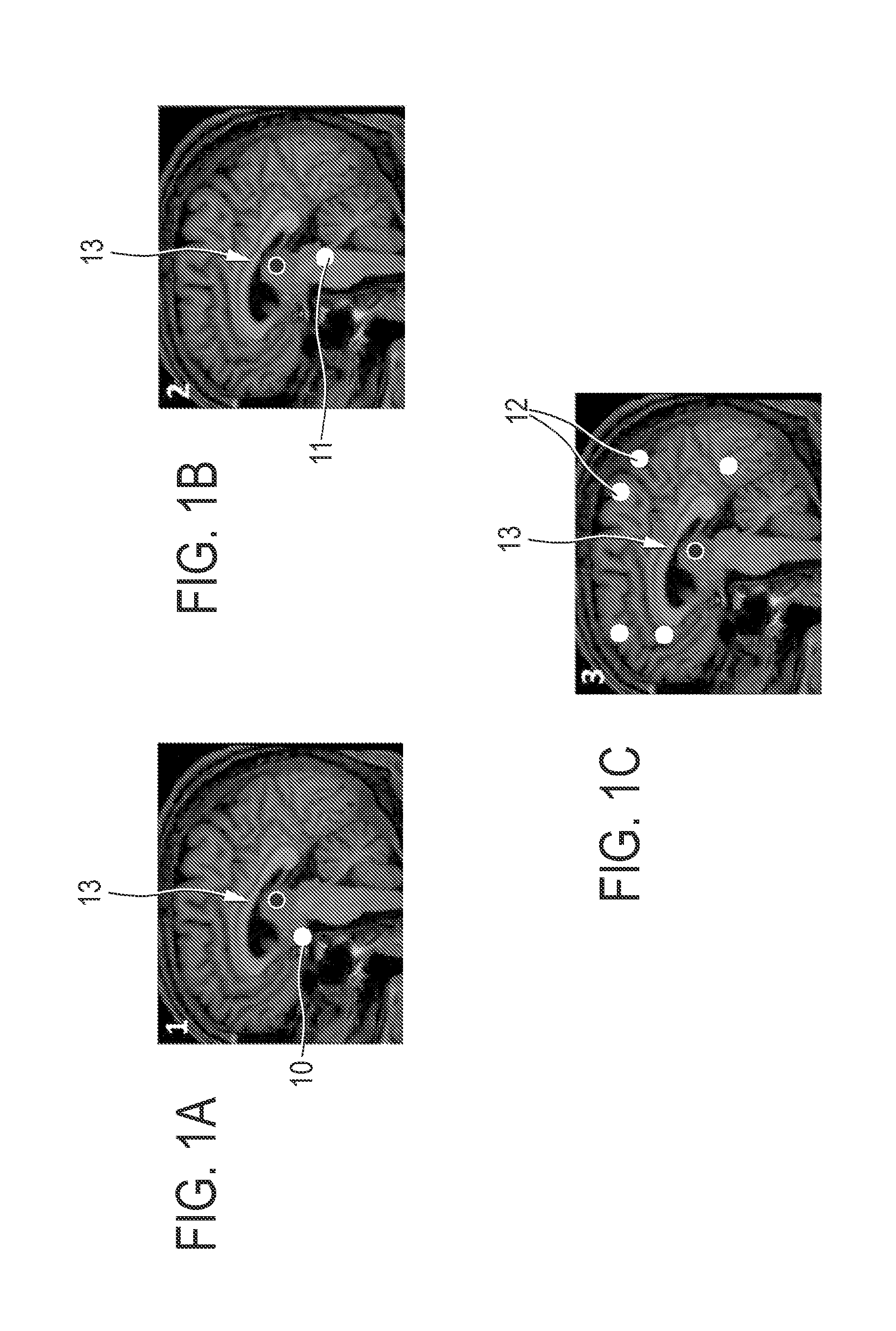 Device and method for cognitive enhancement of a user