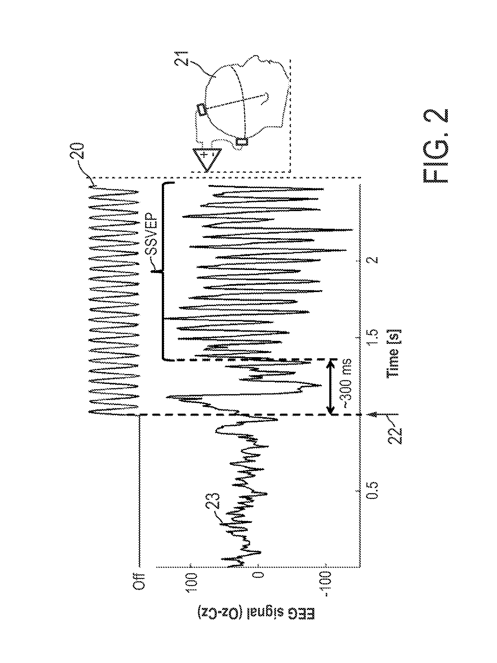 Device and method for cognitive enhancement of a user