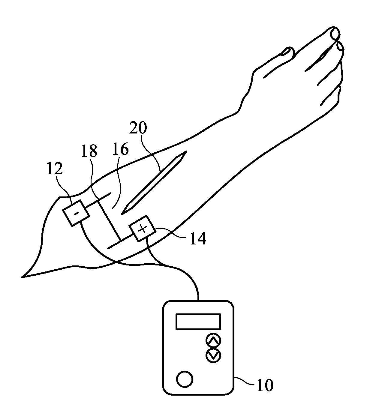 System and Method for Pain-Free Injections
