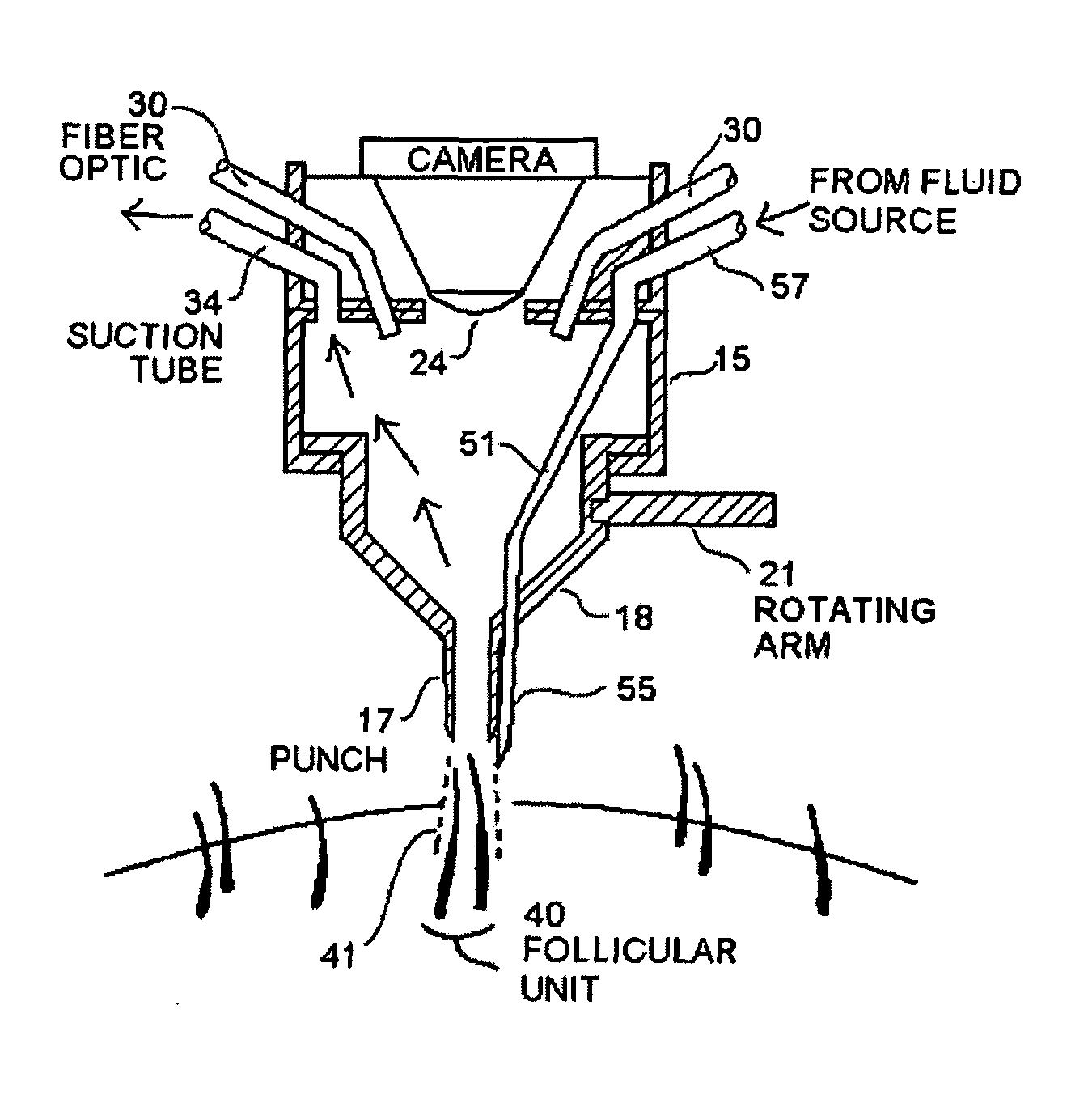 Hair harvesting device and method with localized subsurface dermal fluid insertion