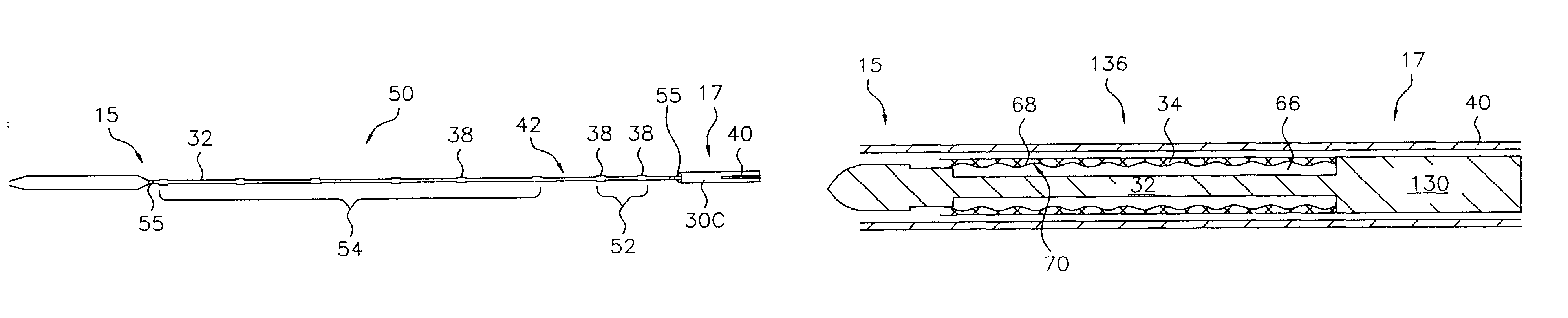 Stent delivery system with nested stabilizer and method of loading and using same