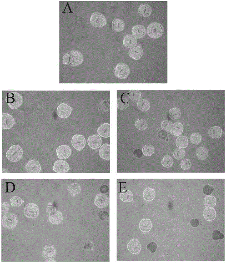 Application of cholic acid as active ingredient in preparation of medicine for treatment of echinococcosis granulosa