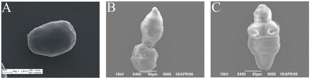 Application of cholic acid as active ingredient in preparation of medicine for treatment of echinococcosis granulosa