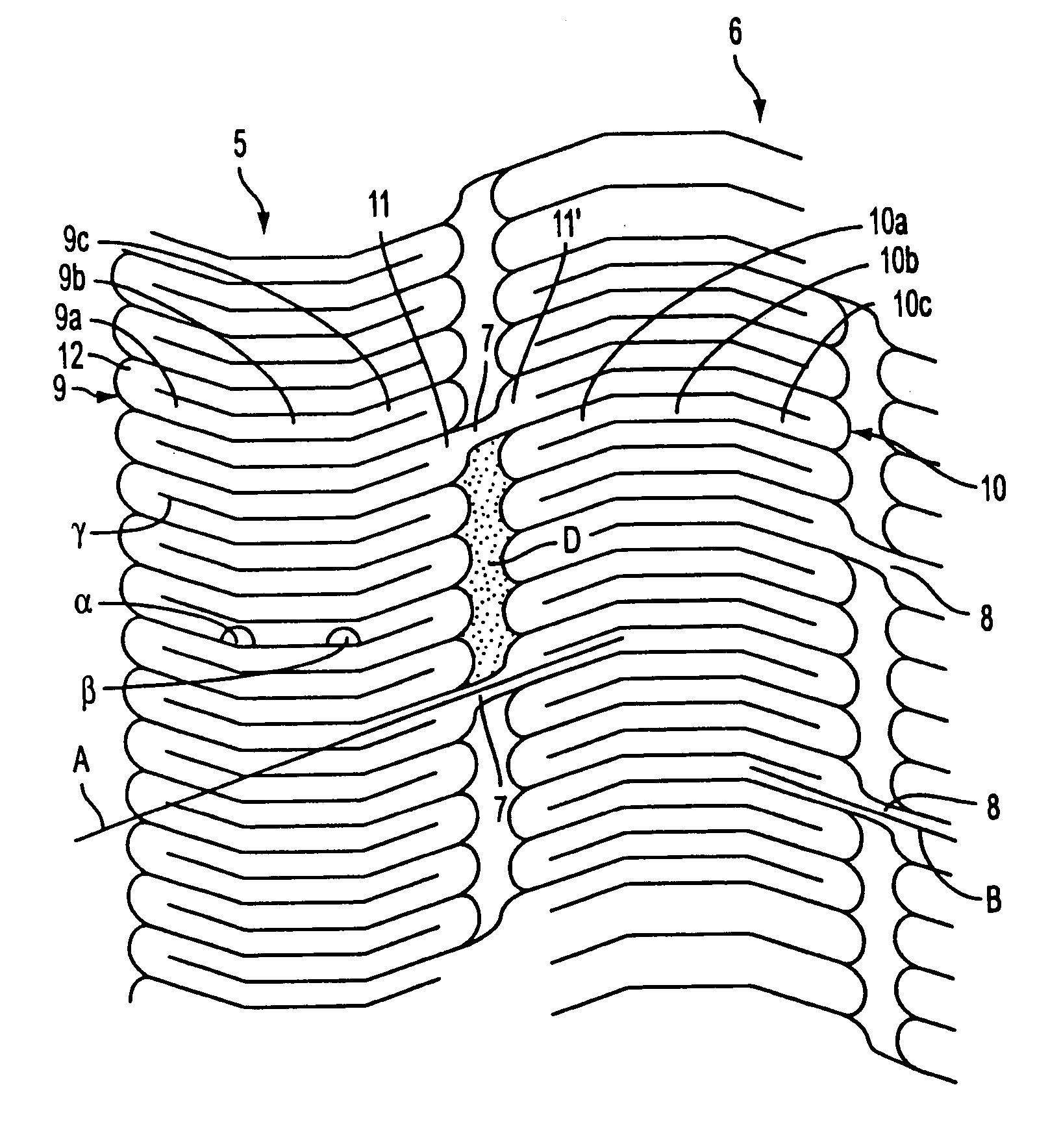 Methods and apparatus for stenting comprising enhanced embolic protection coupled with improved protecions against restenosis and thrombus formation