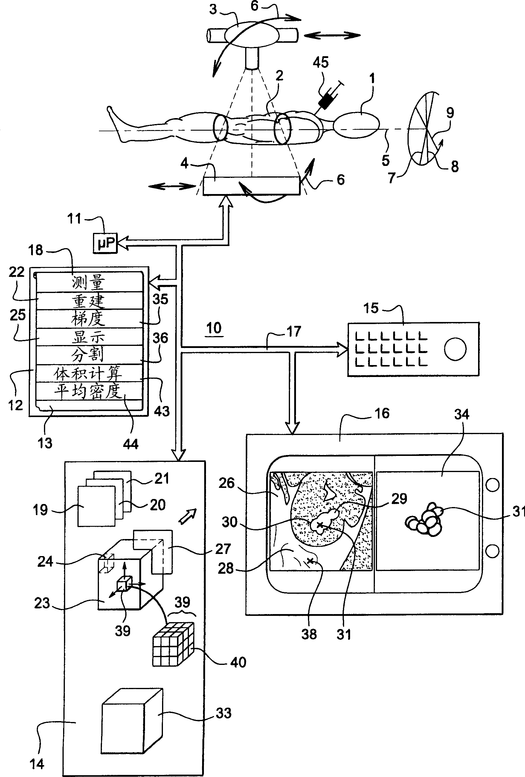 Method and apparatus for the preparation of a renal image