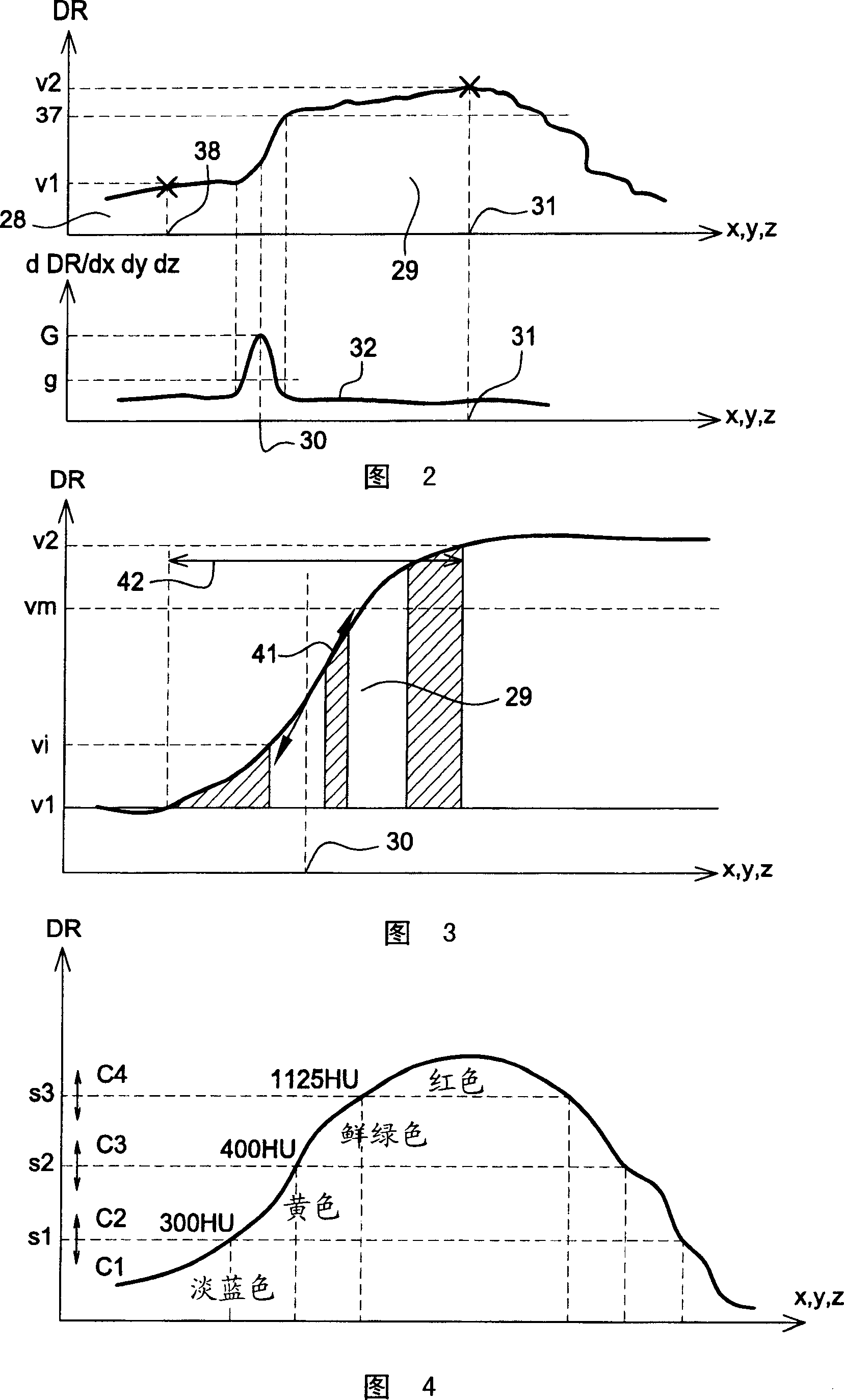 Method and apparatus for the preparation of a renal image