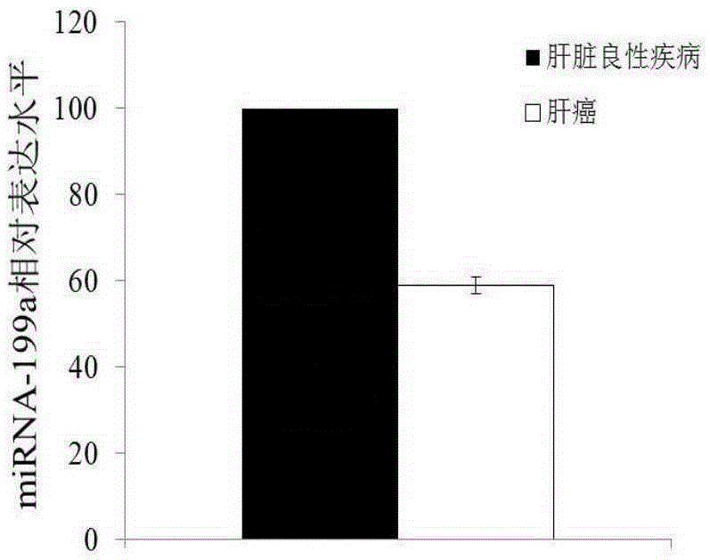 Use of mirna-199a in the preparation of diagnostic kits