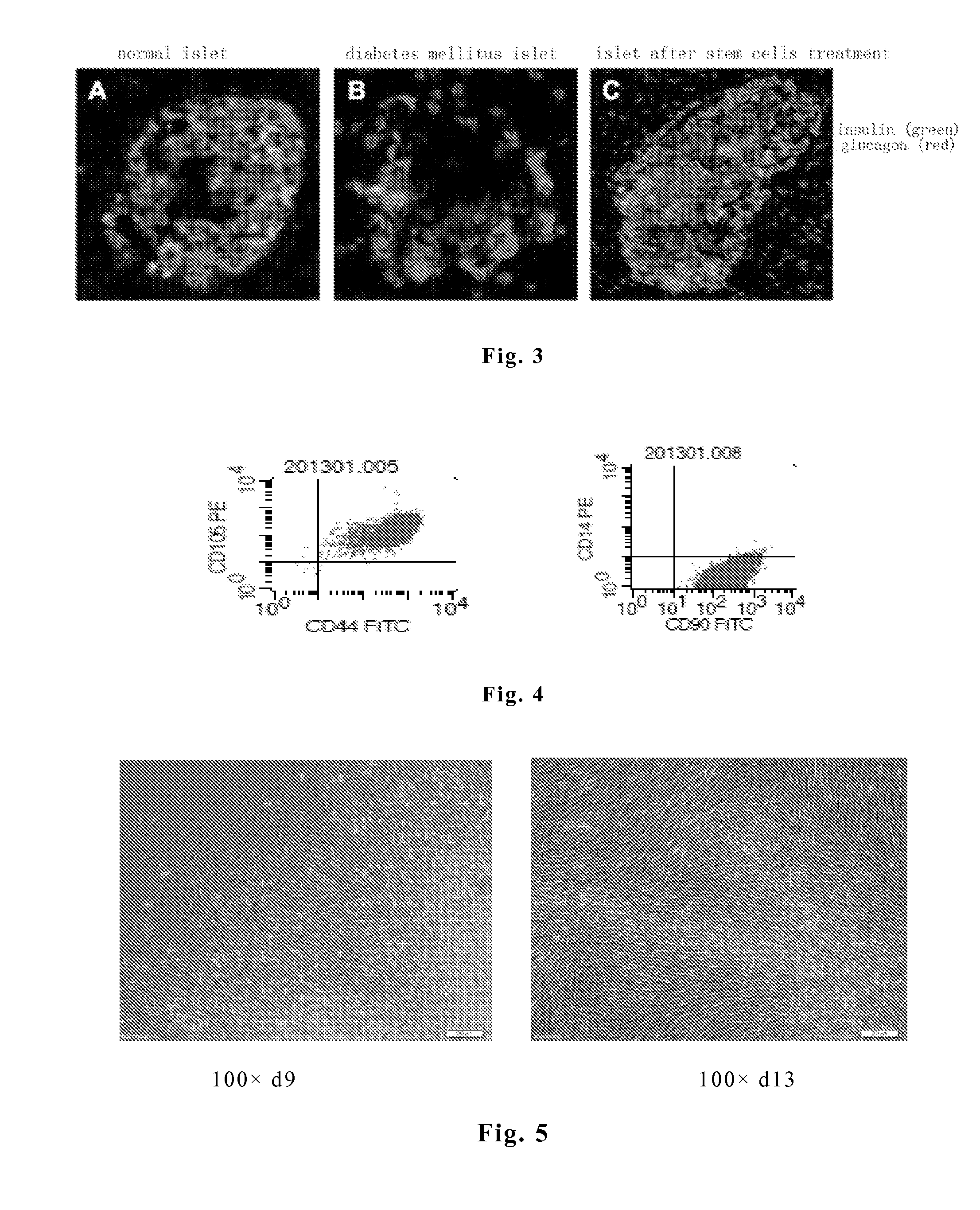 Mesenchymal stem cell injection and preparation method thereof, and application thereof in preparing diabetes drug