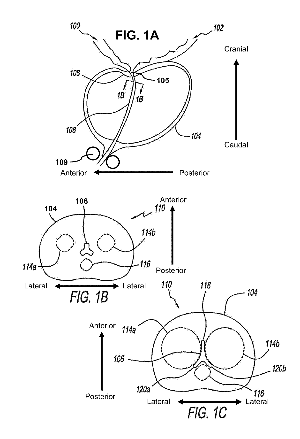 Dilating device and method for prostatic urethra