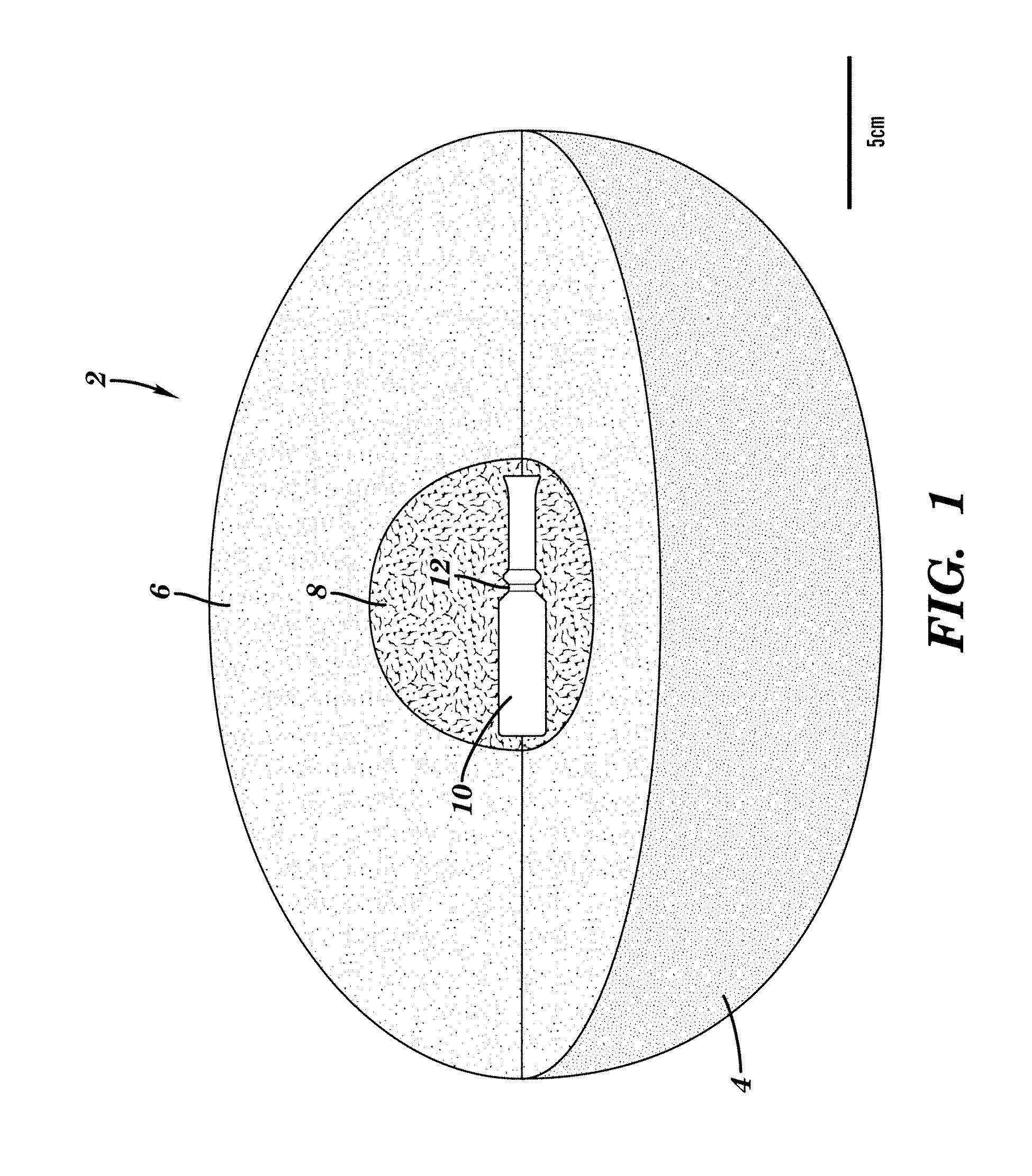 Device and method for reducing tension and stress in a subject