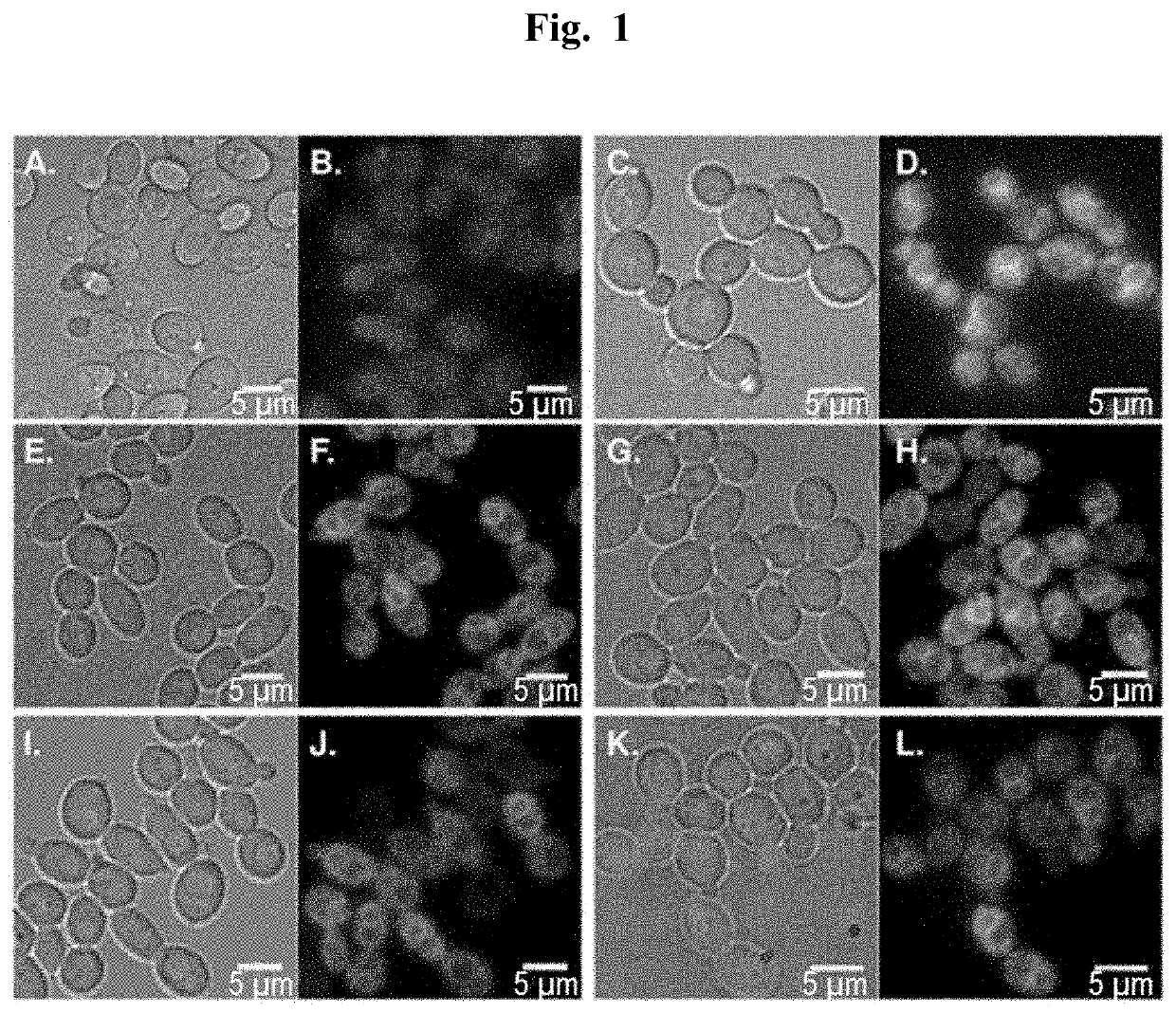 Fluorescent endoplasmic reticulum trackers for live cell imaging of pathogenic yeast