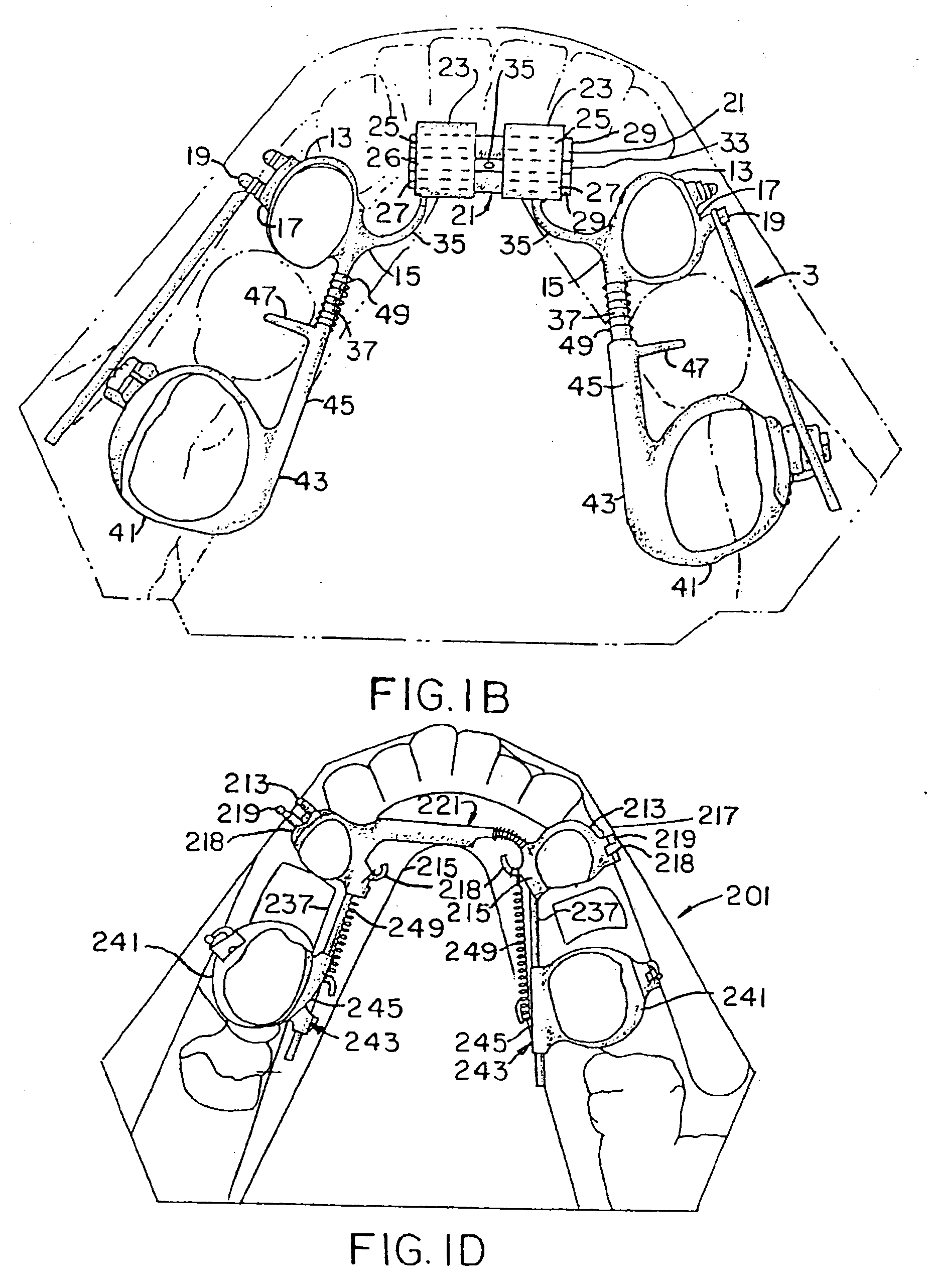 Slide on connector for arch wire