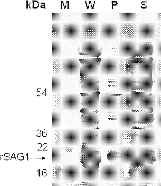 Method for detecting toxoplasma antibody