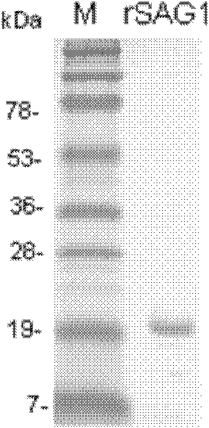 Method for detecting toxoplasma antibody