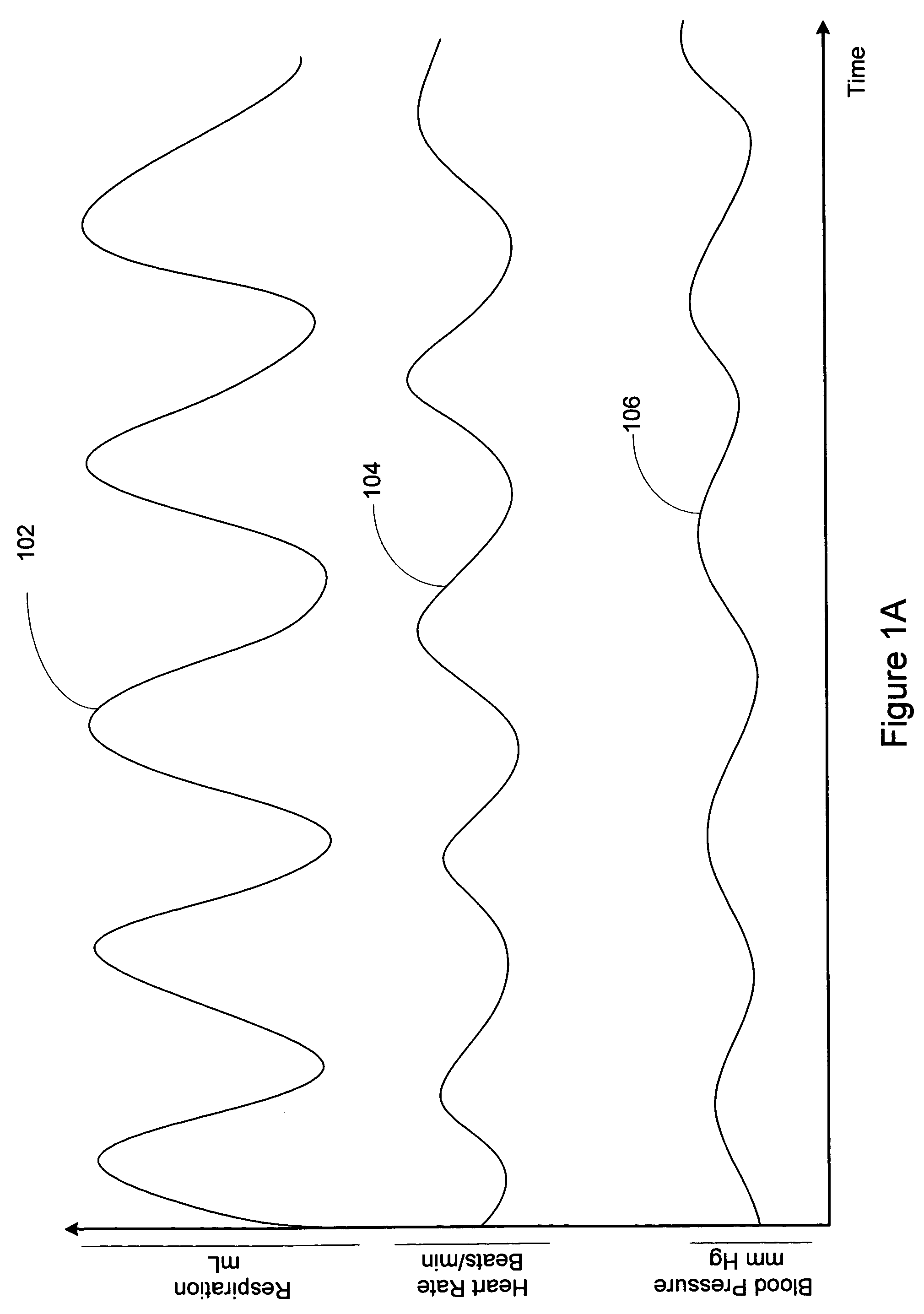 Method and apparatus for mimicking respiratory sinus arrhythmia with cardiac pacing controlled via external respiration therapy device