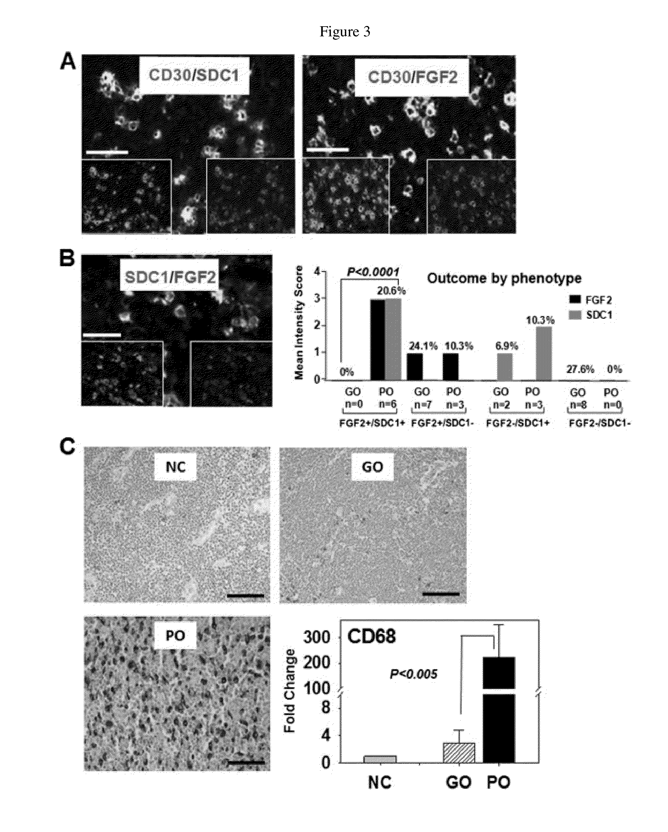 Fibroblast growth factor-2 (FGF2) and syndecan-1 (SDC1) as biomarkers for poor outcome hodgkin lymphoma patients