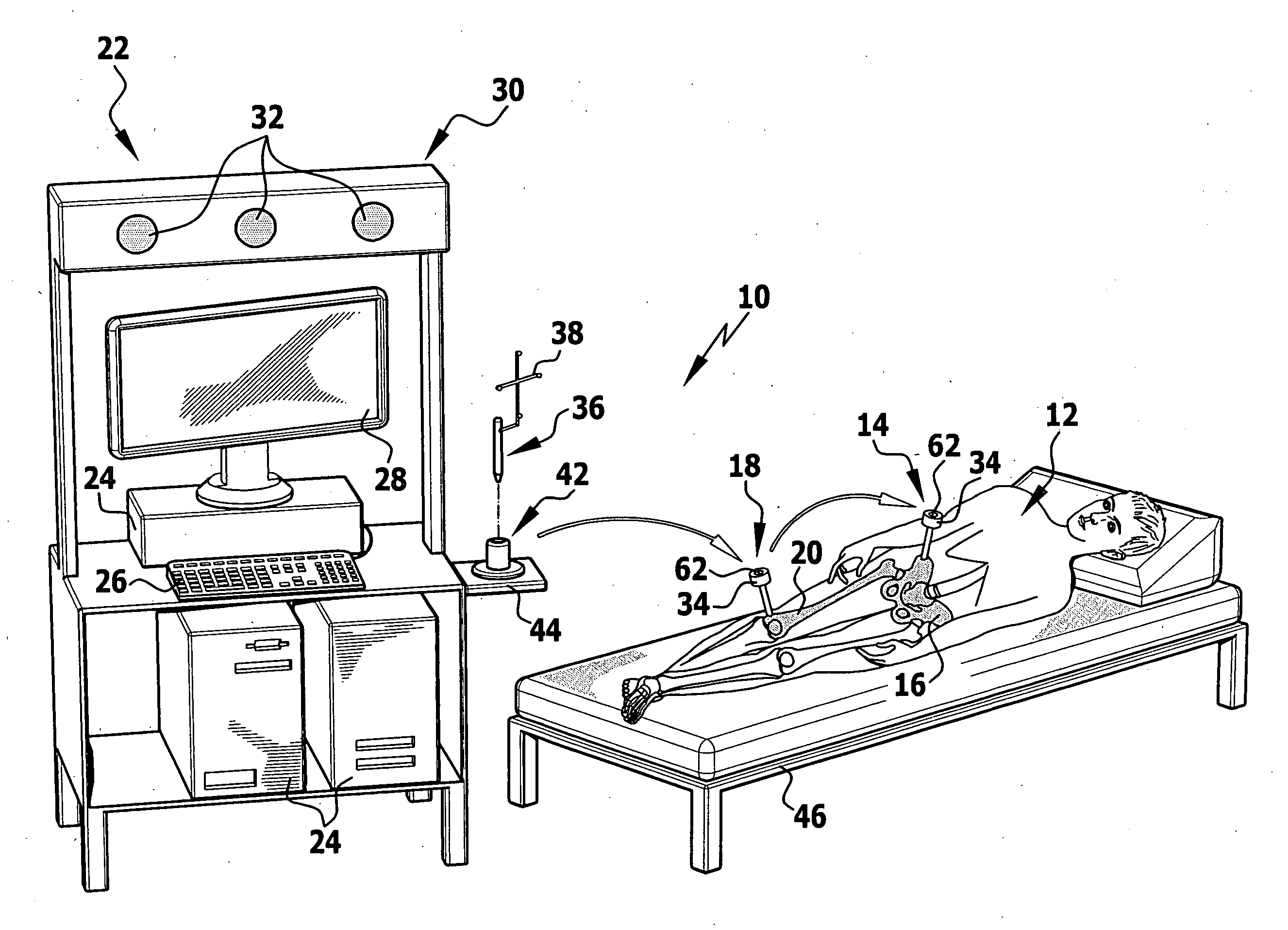 Calibration method and calibration device for a surgical referencing unit