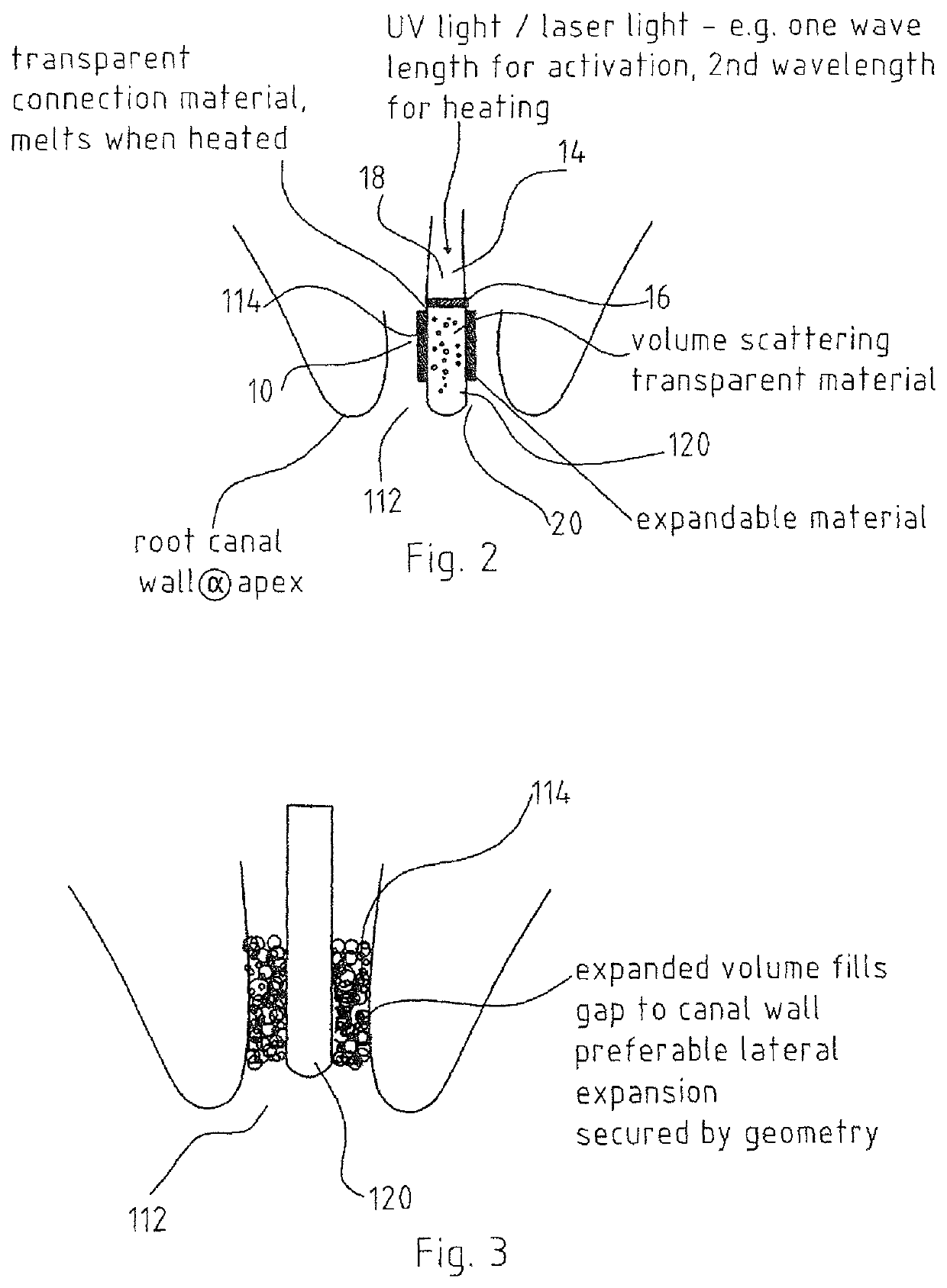 Method for sealing of a canal