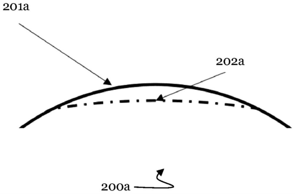 Customized cutting for correcting ametropia