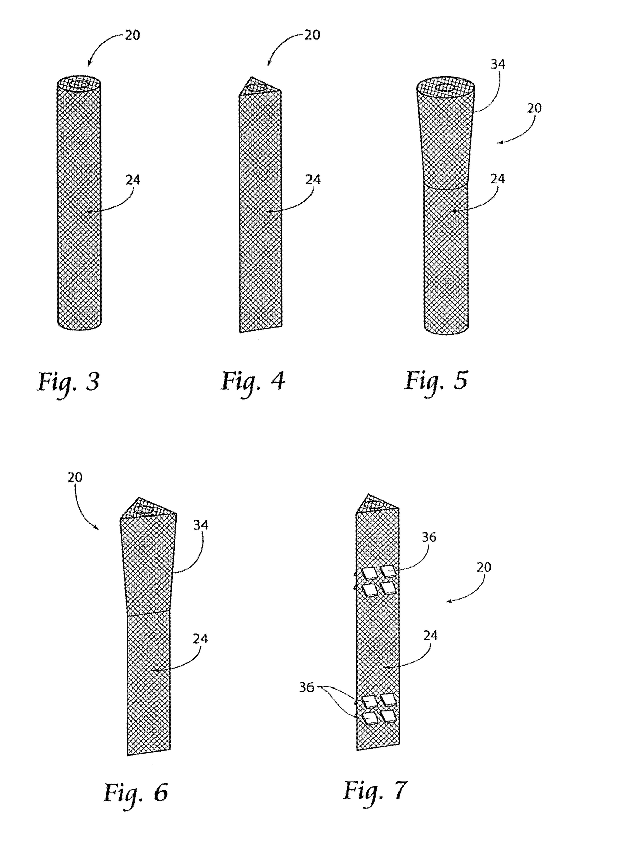 Apparatus, systems, and methods for the fixation or fusion of bone
