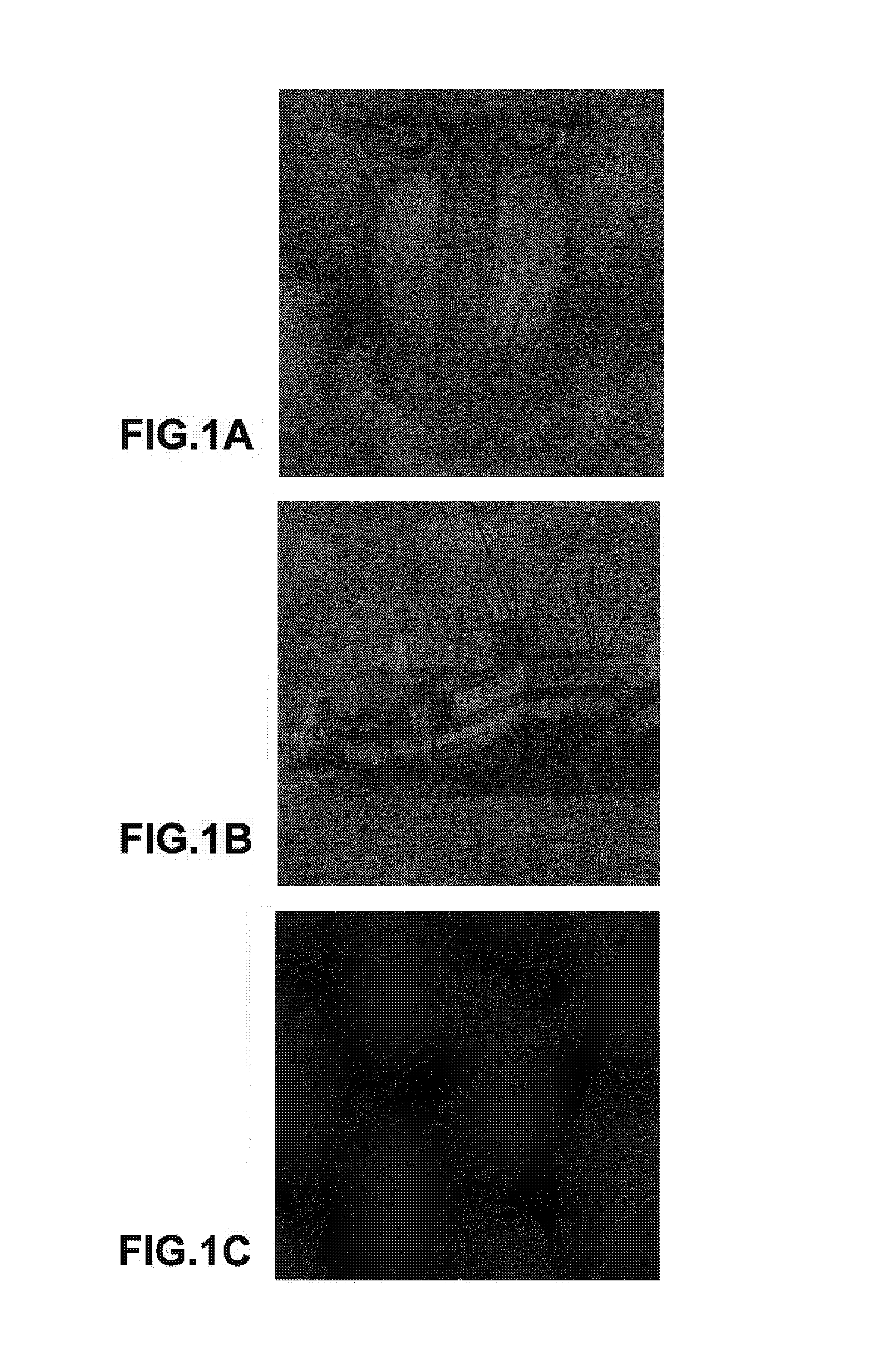 Method and system for embedding an image into two other images