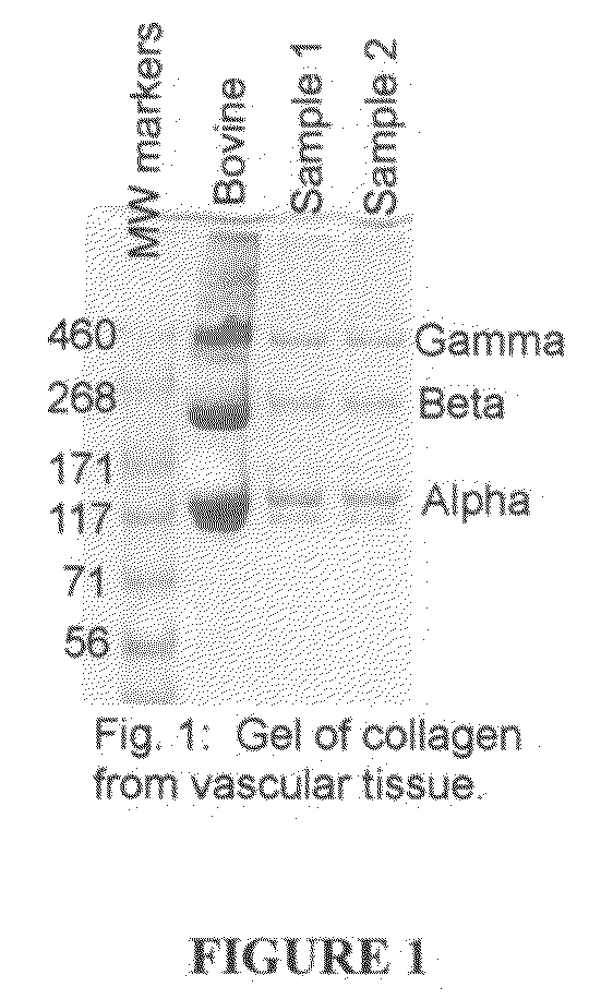 Compositions and methods for soft tissue augmentation