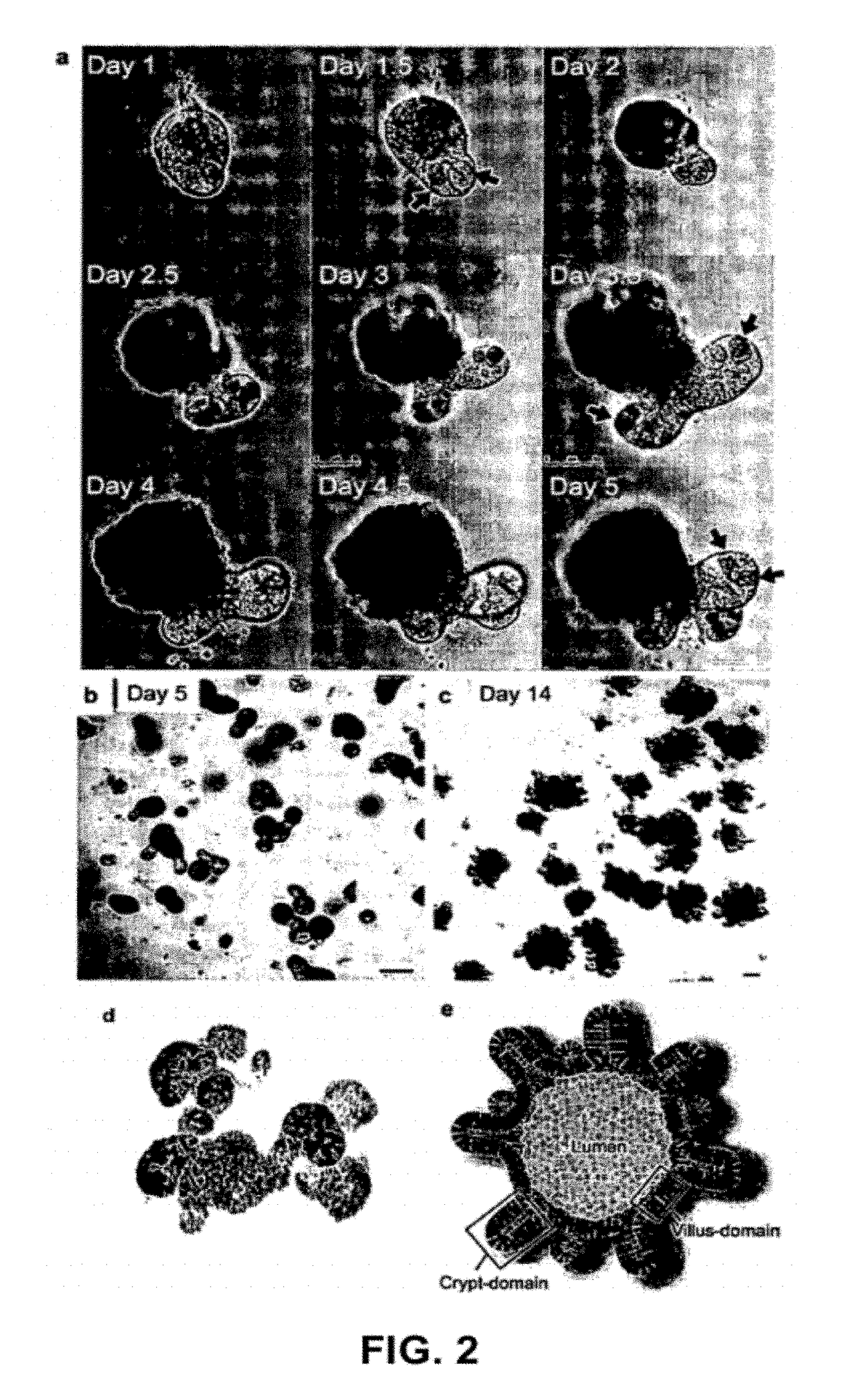 Culture medium for epithelial stem cells and organoids comprising the stem cells