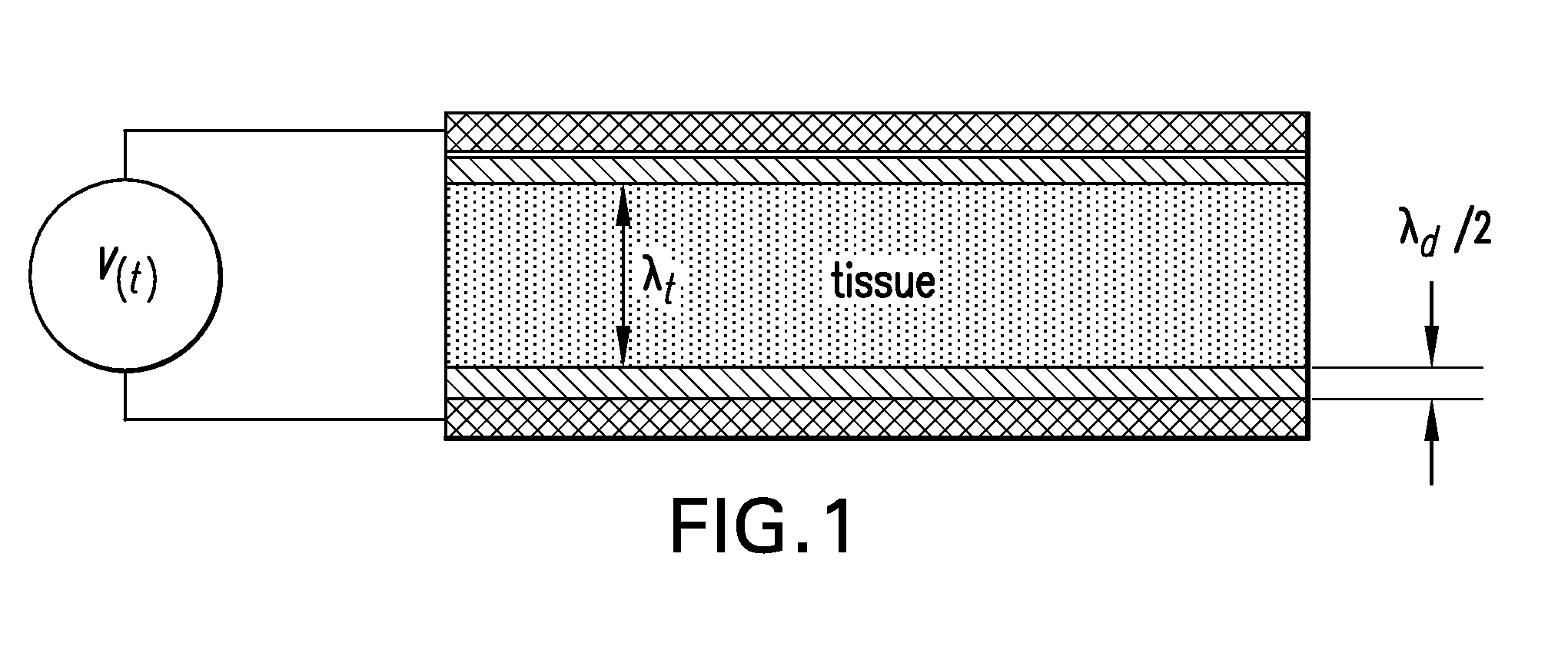 Electrode Geometries and Method for Applying Electric Field Treatment to Parts of the Body