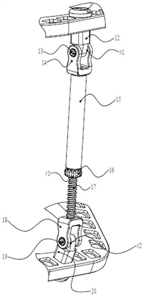 A parallel external fixator system for single-plane deformity correction of ankle