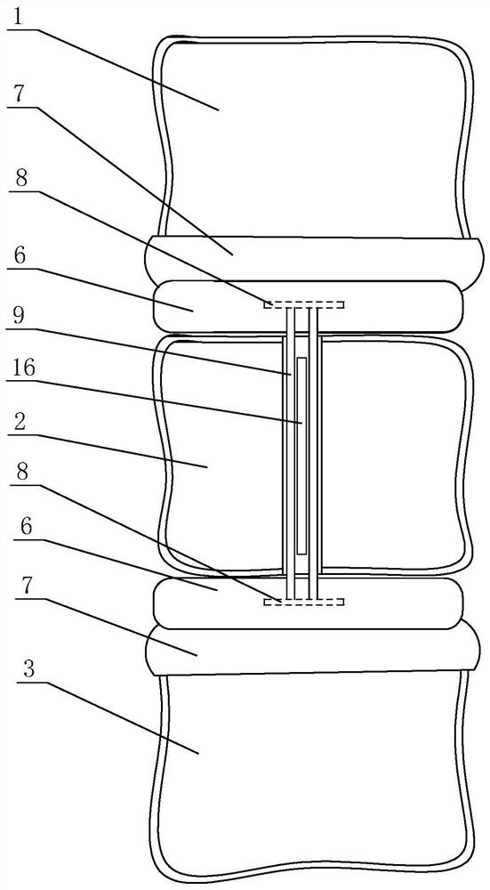 Hidden vertebra support replacement body