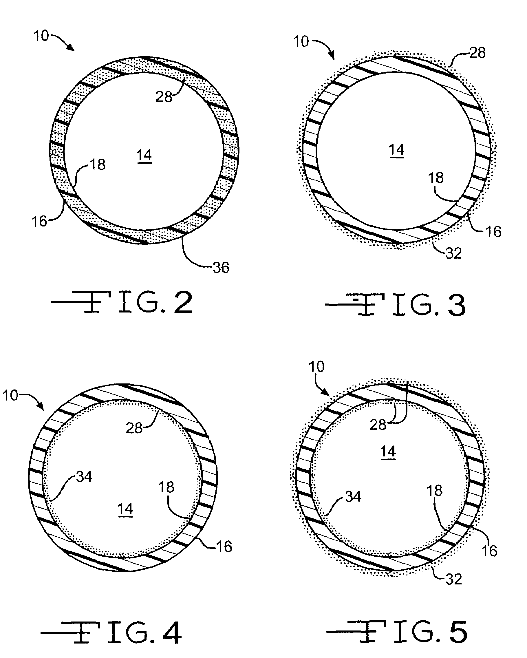 Medical device with therapeutic agents